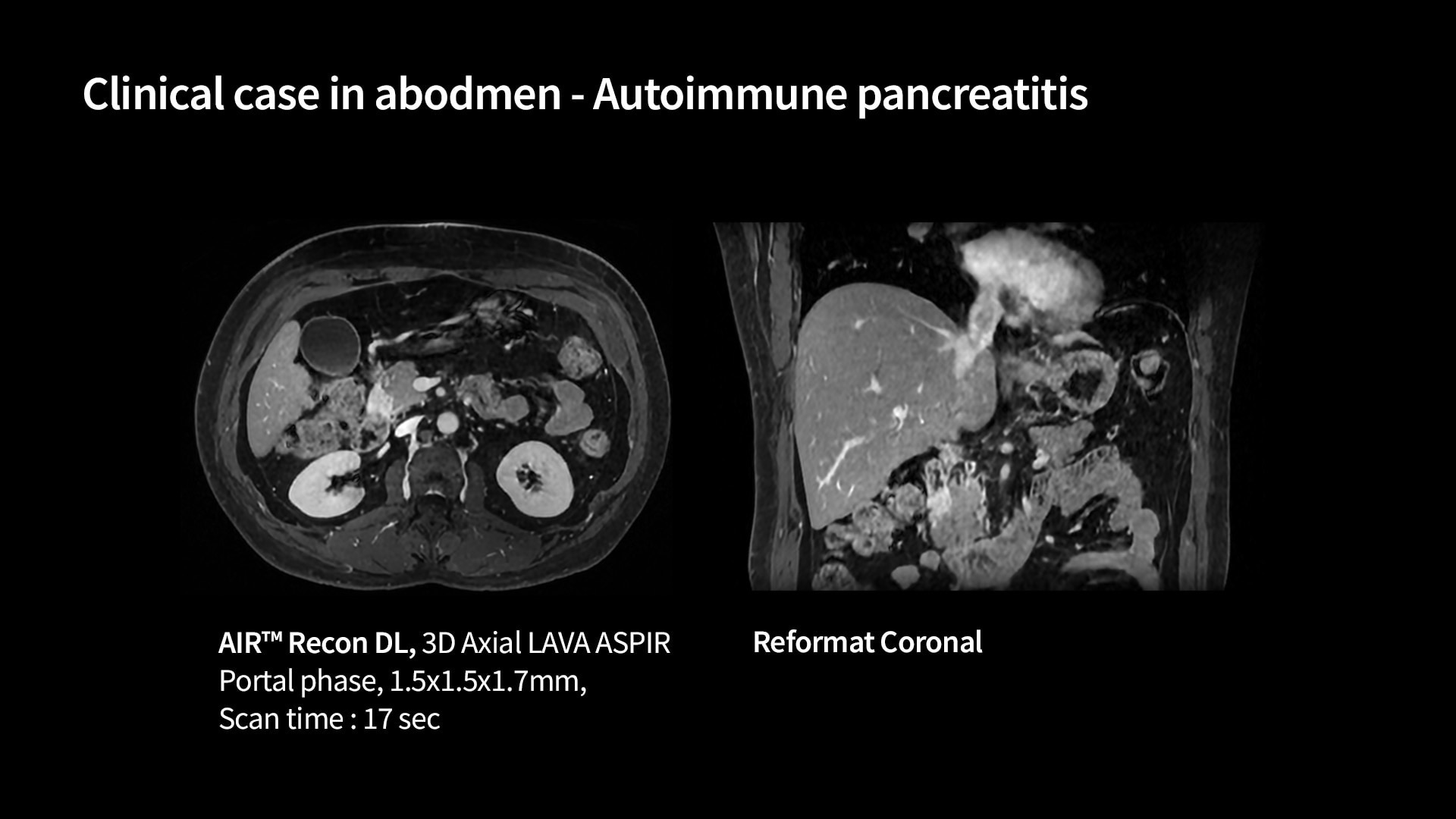 Product Media Carousel Image
