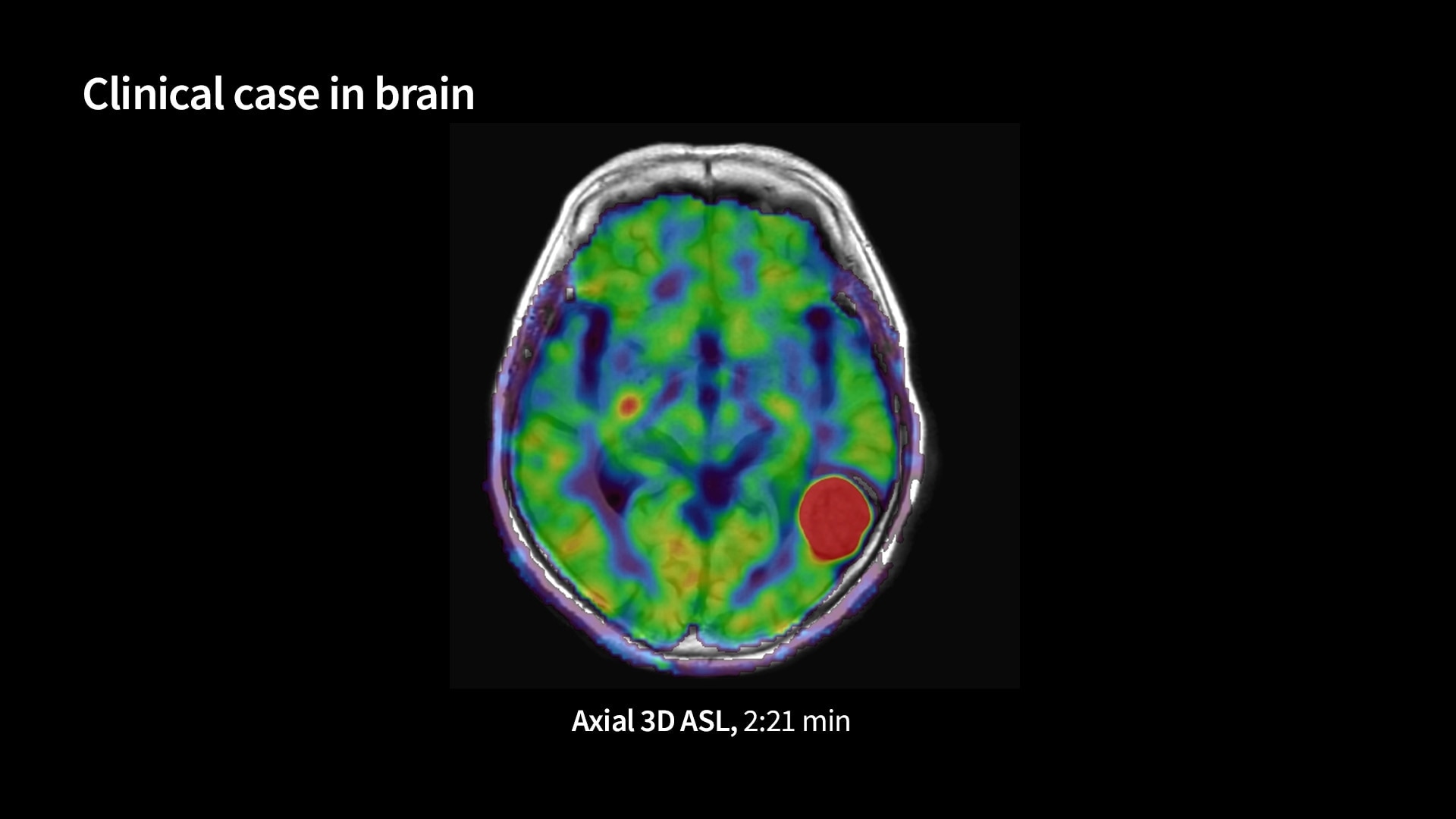 Product Media Carousel Image