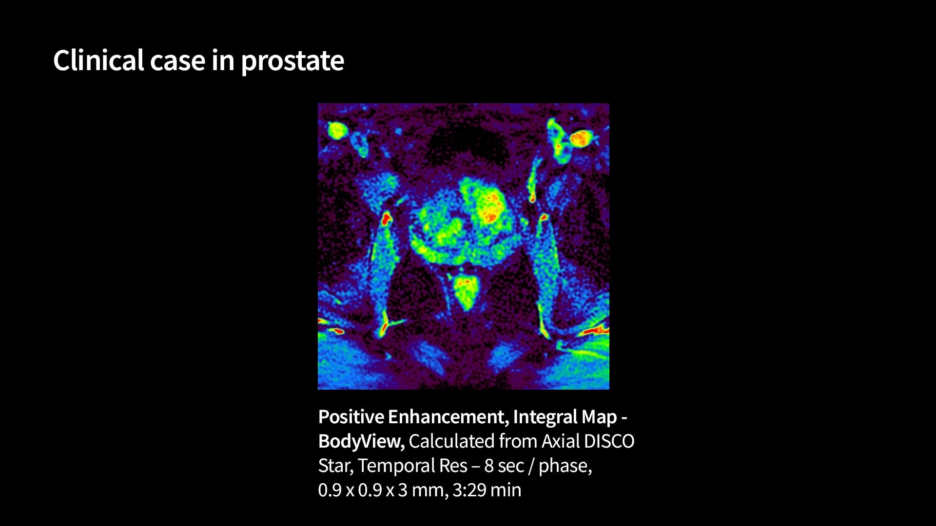 Product Media Carousel Image