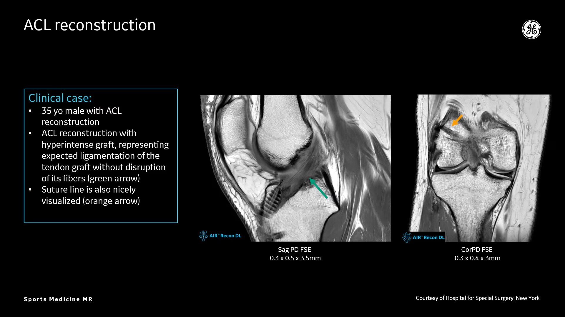 Product Media Carousel Image