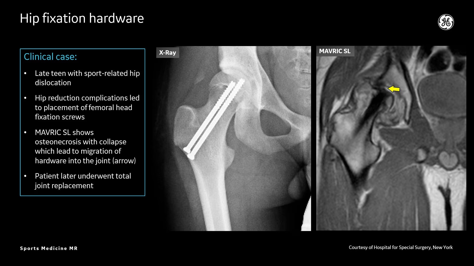 Product Media Carousel Image