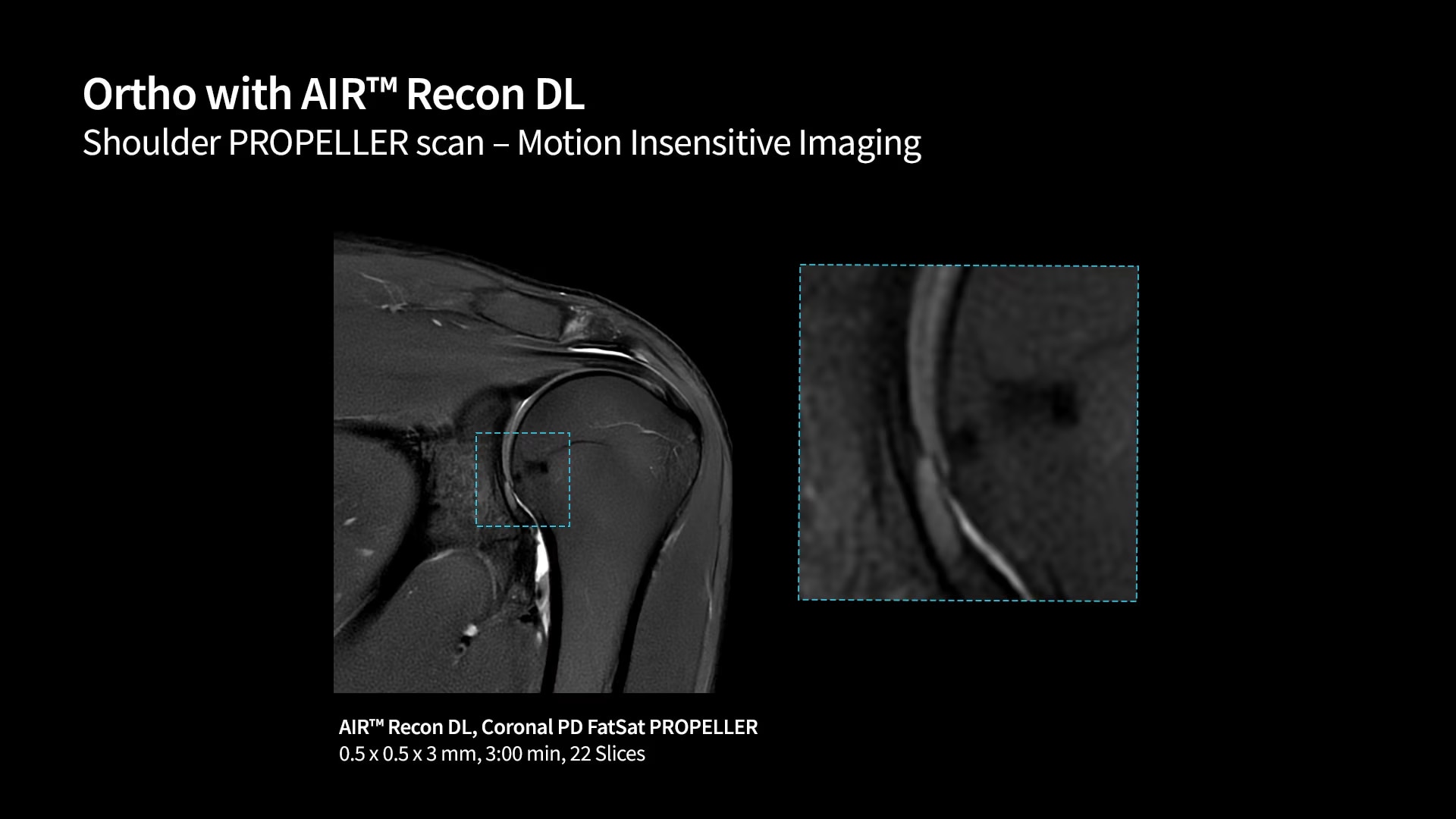Product Media Carousel Image