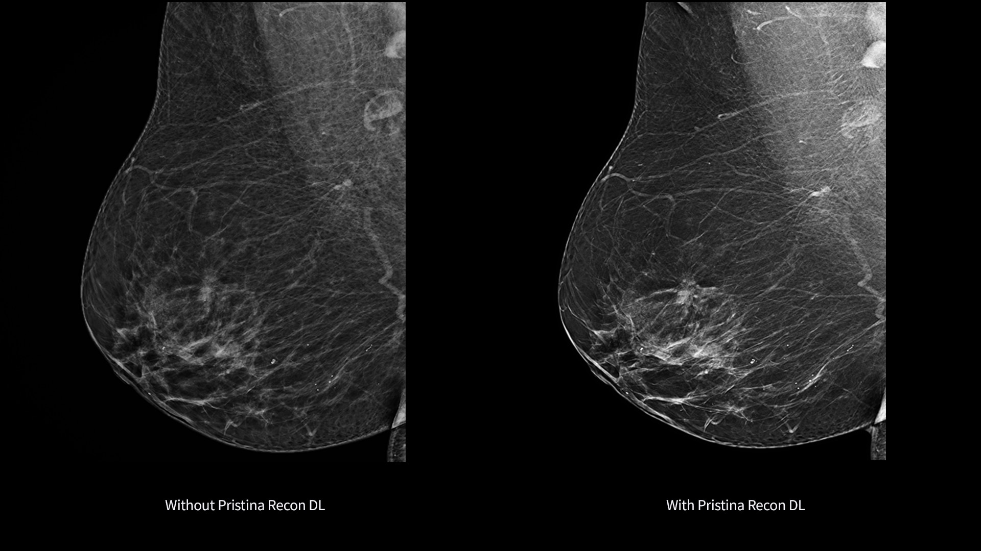 Product Media Carousel Image