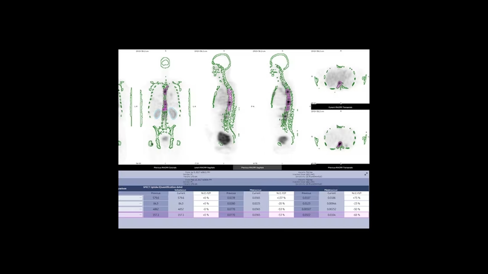 Product Media Carousel Image