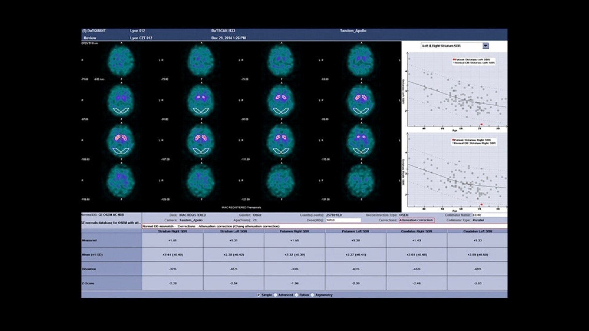 Product Media Carousel Image