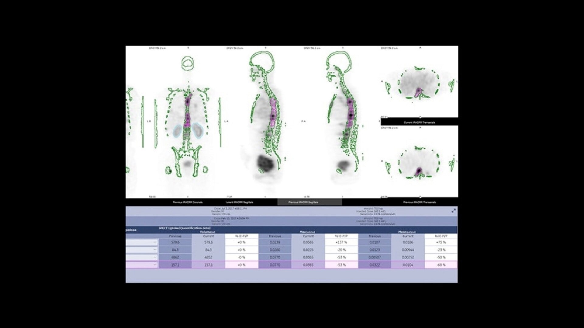 Product Media Carousel Image