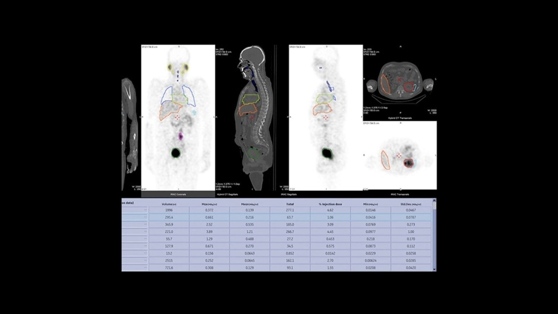 Product Media Carousel Image