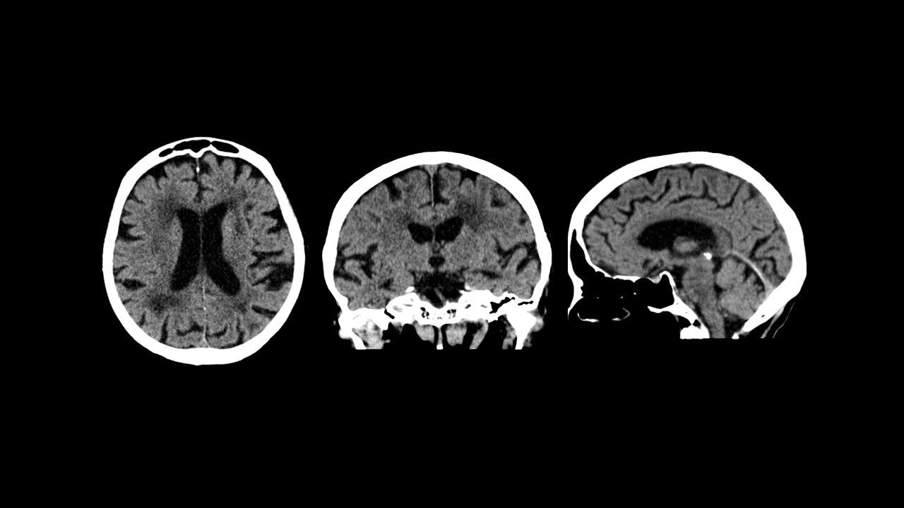 Product Media Carousel Image