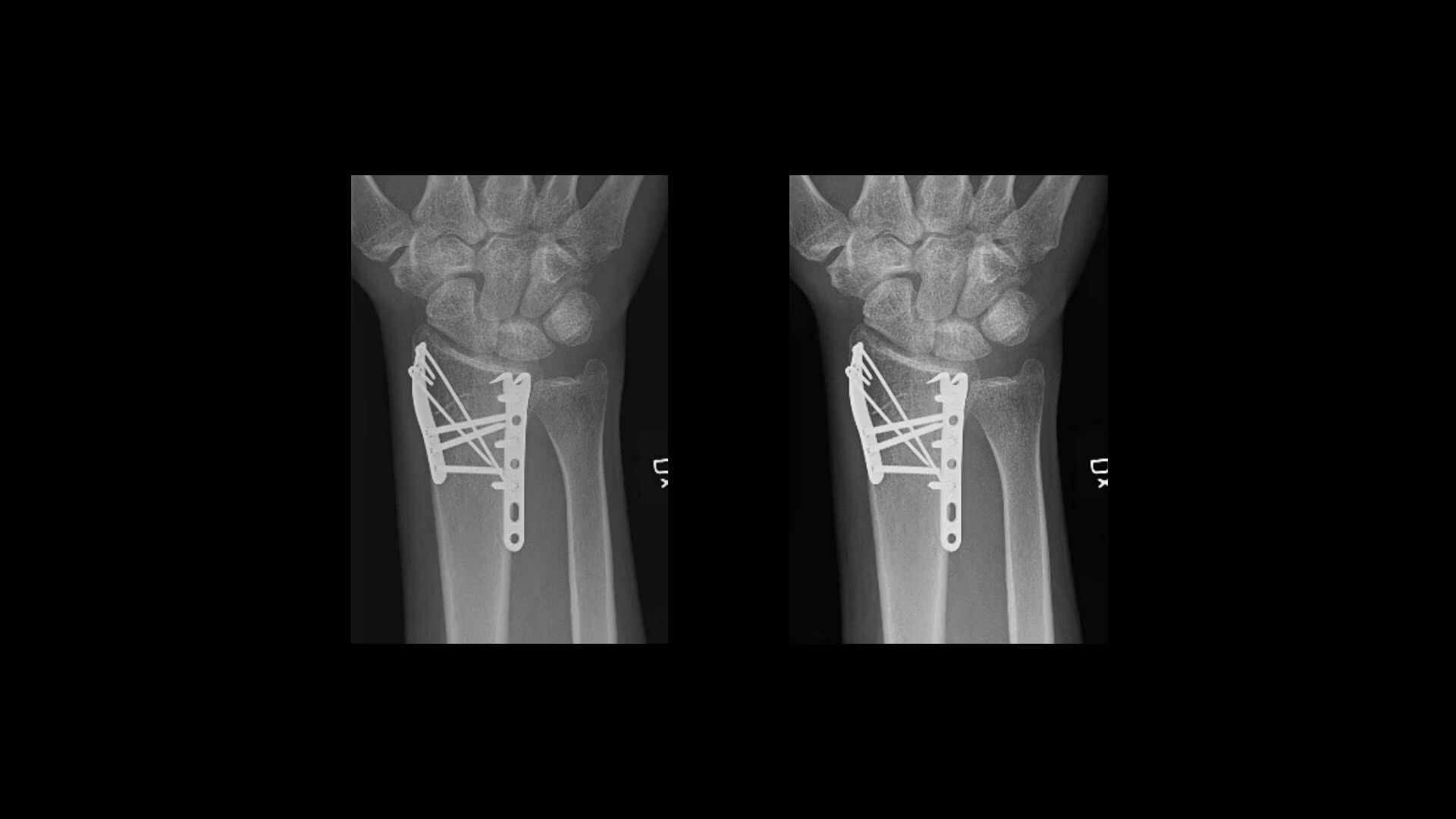 Product Media Carousel Image