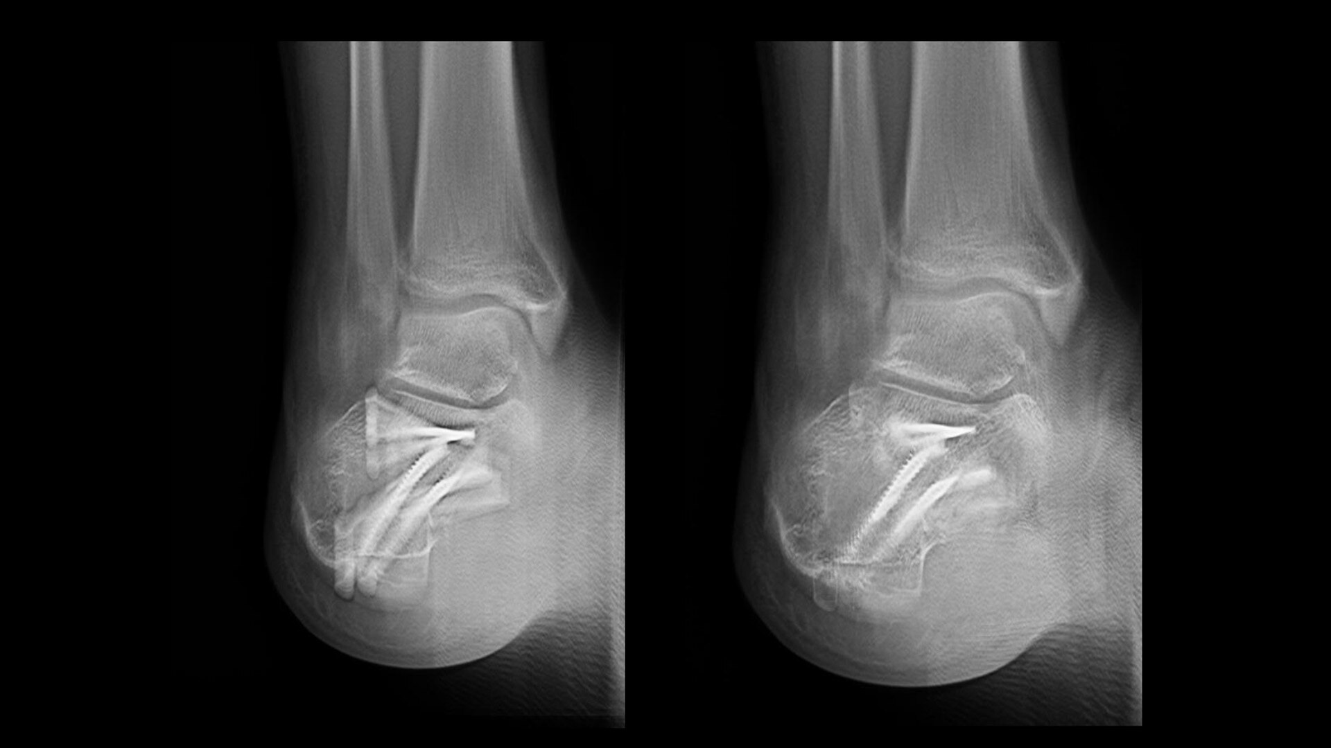 Product Media Carousel Image