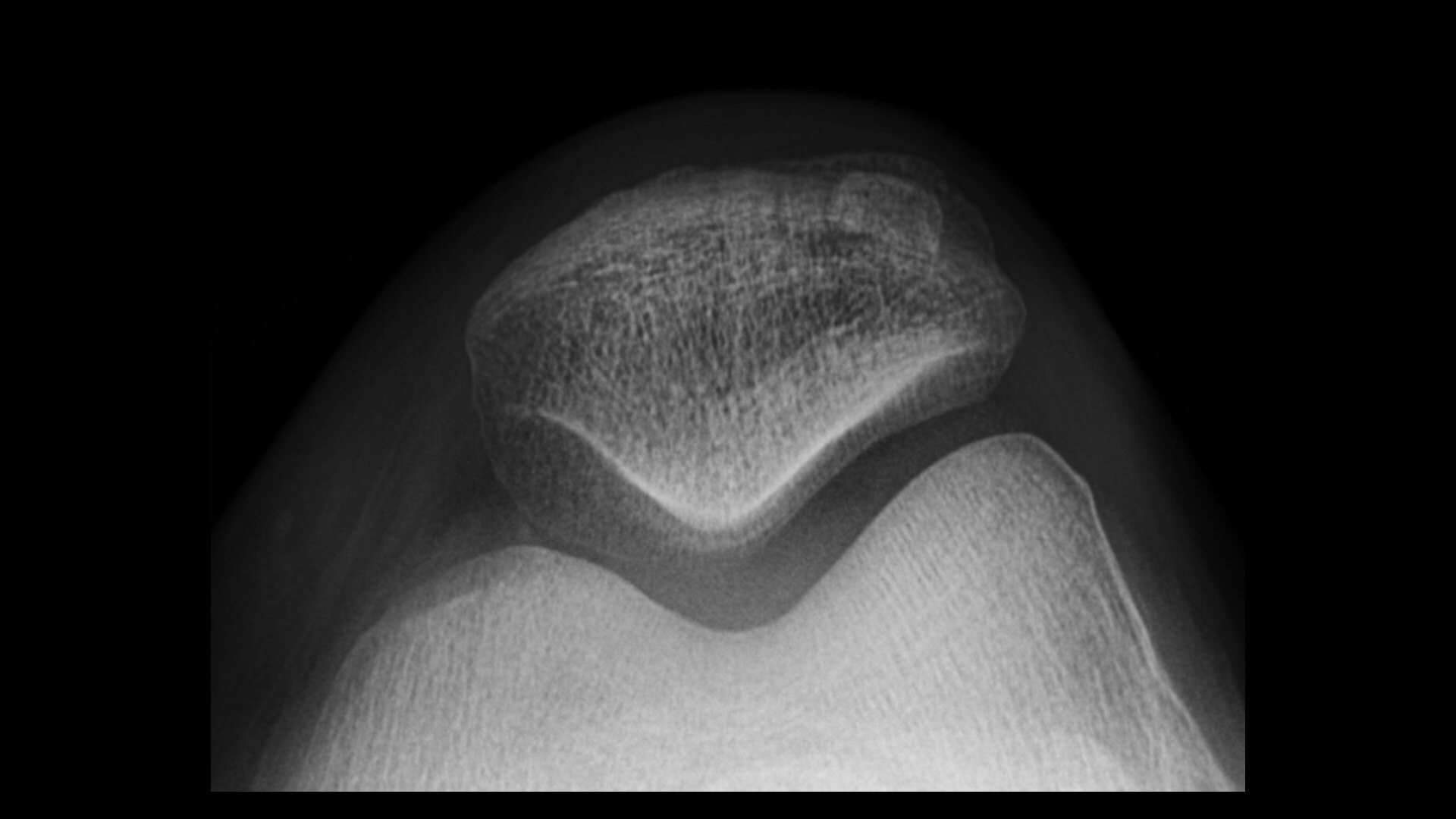 Product Media Carousel Image