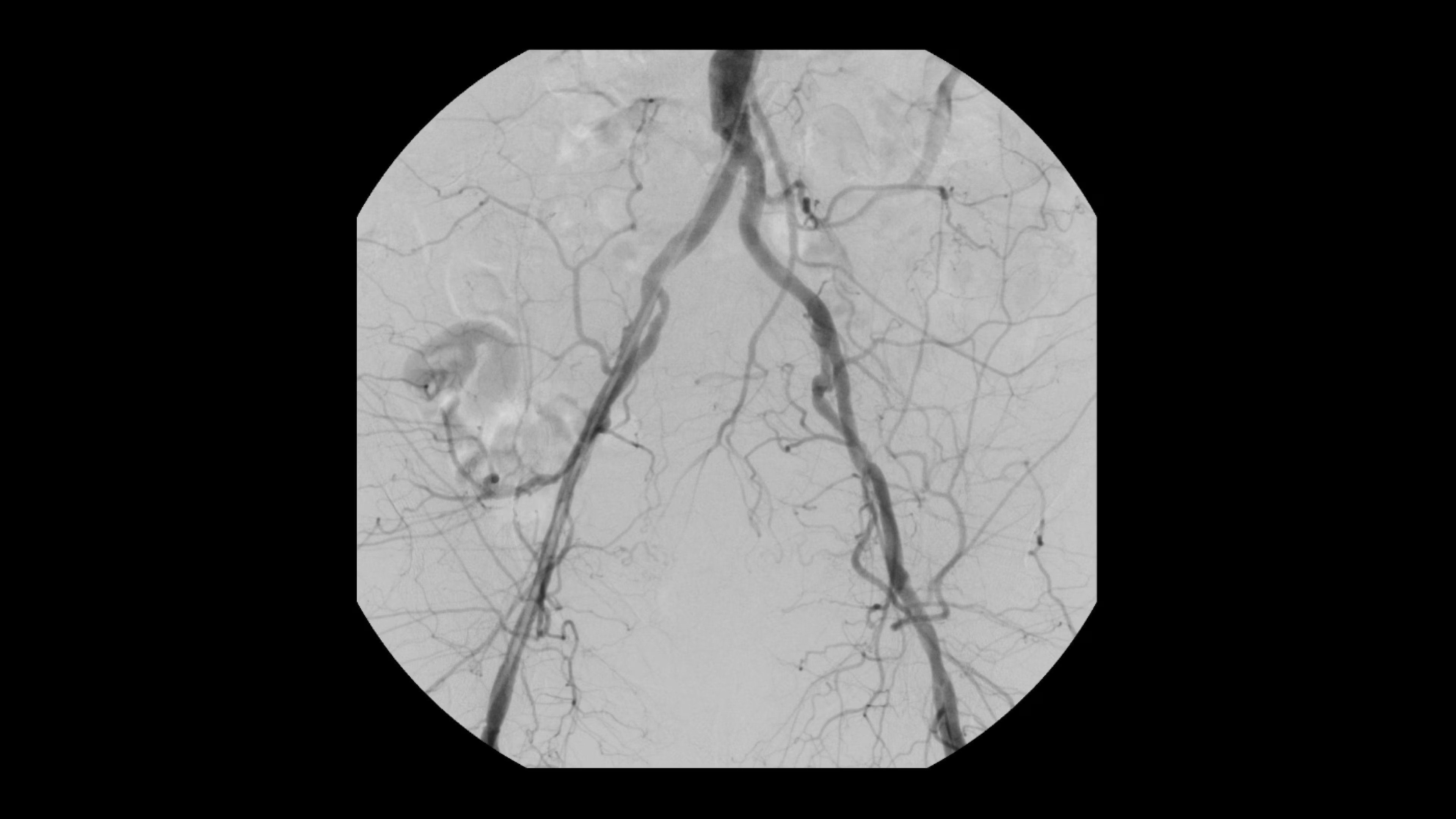 Product Media Carousel Image