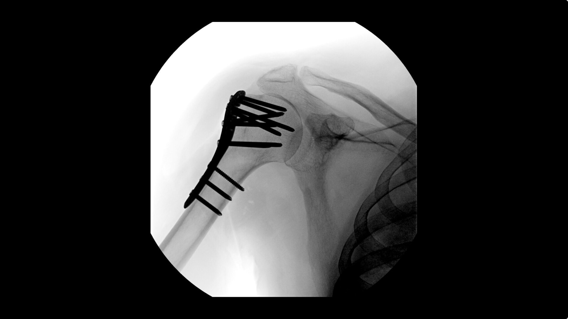 Product Media Carousel Image