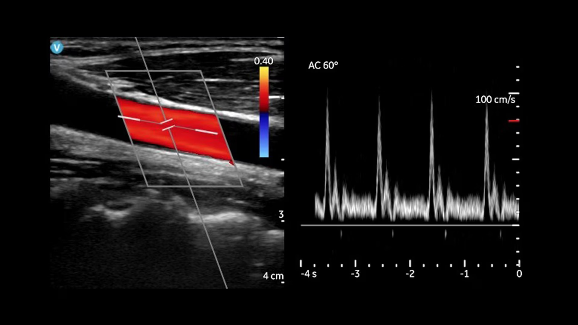 Product Media Carousel Image