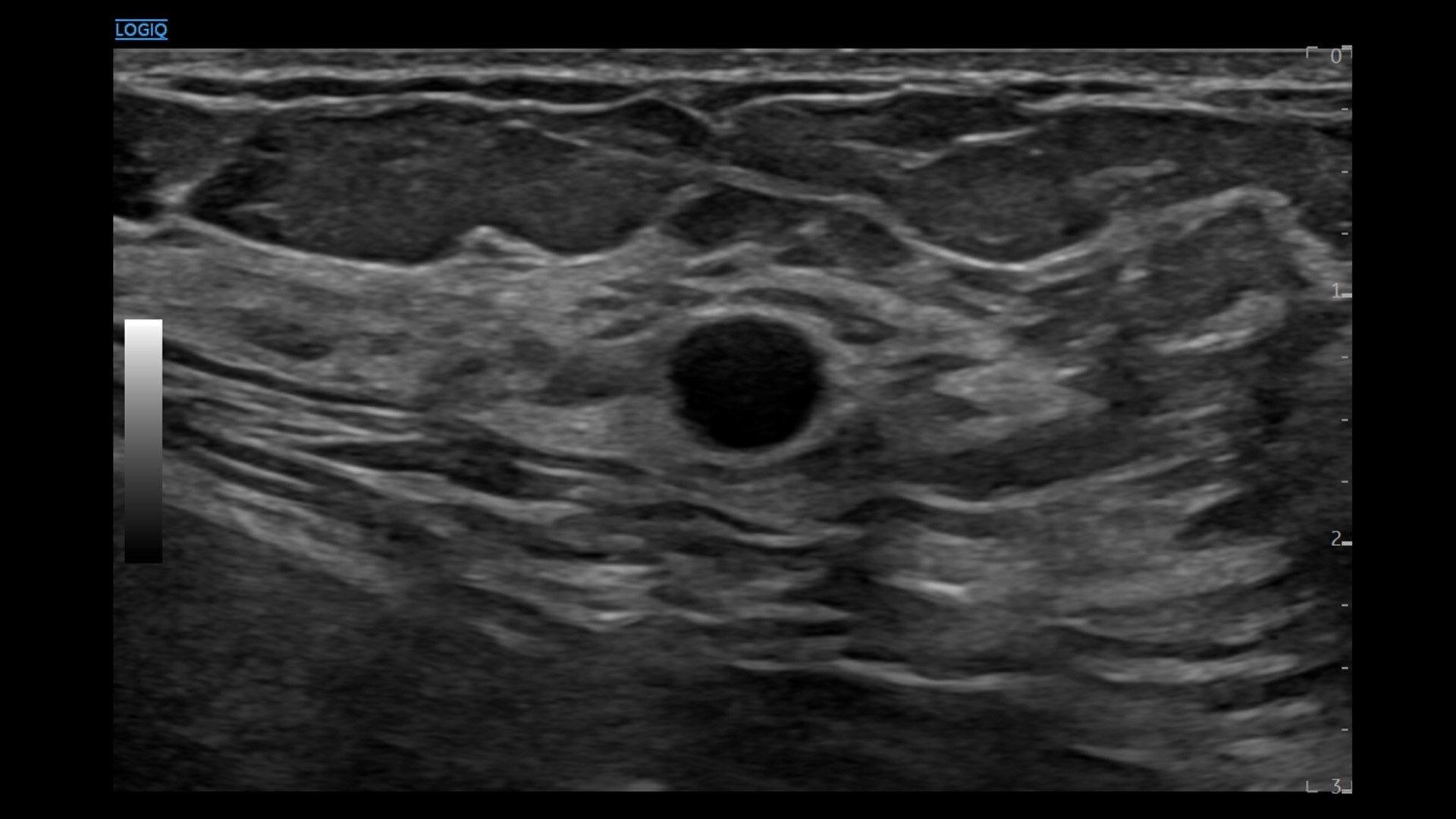 Product Media Carousel Image