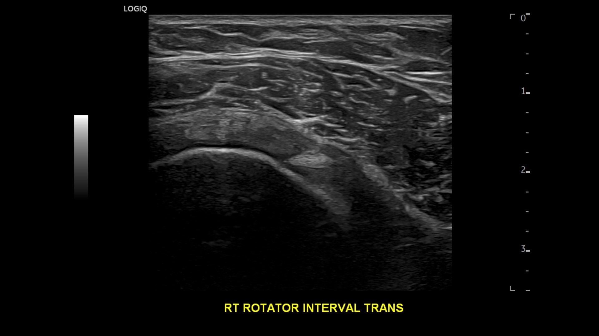 Product Media Carousel Image