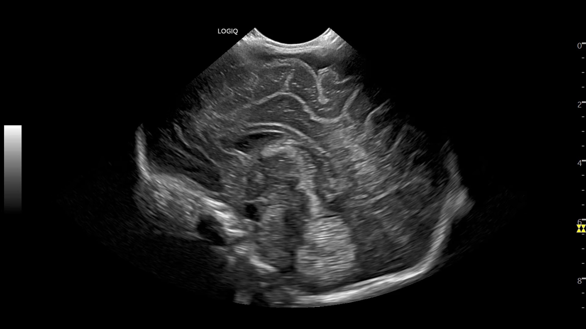 Product Media Carousel Image