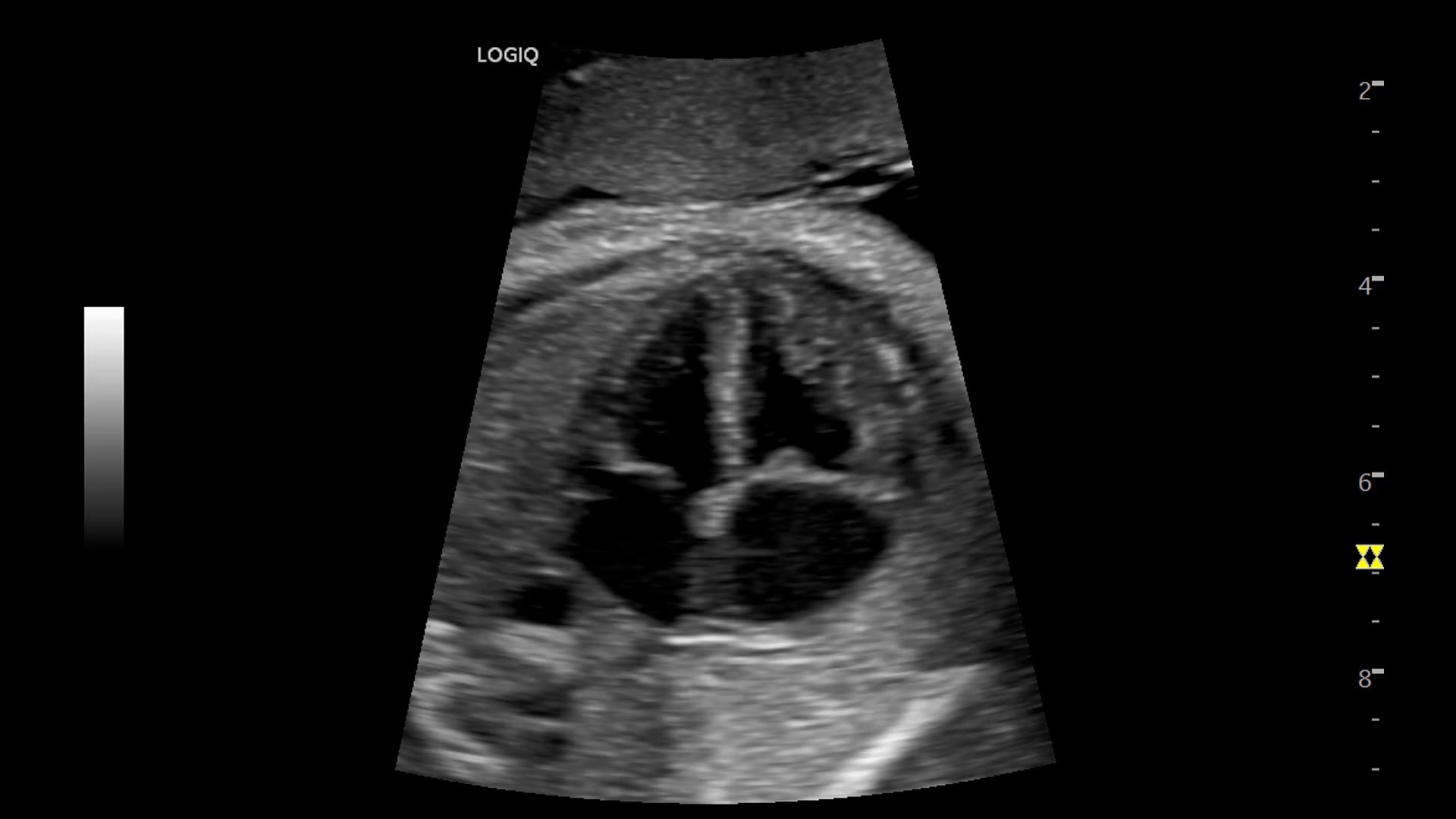 Product Media Carousel Image