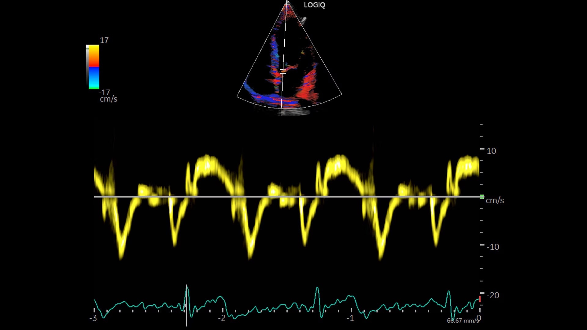 Product Media Carousel Image
