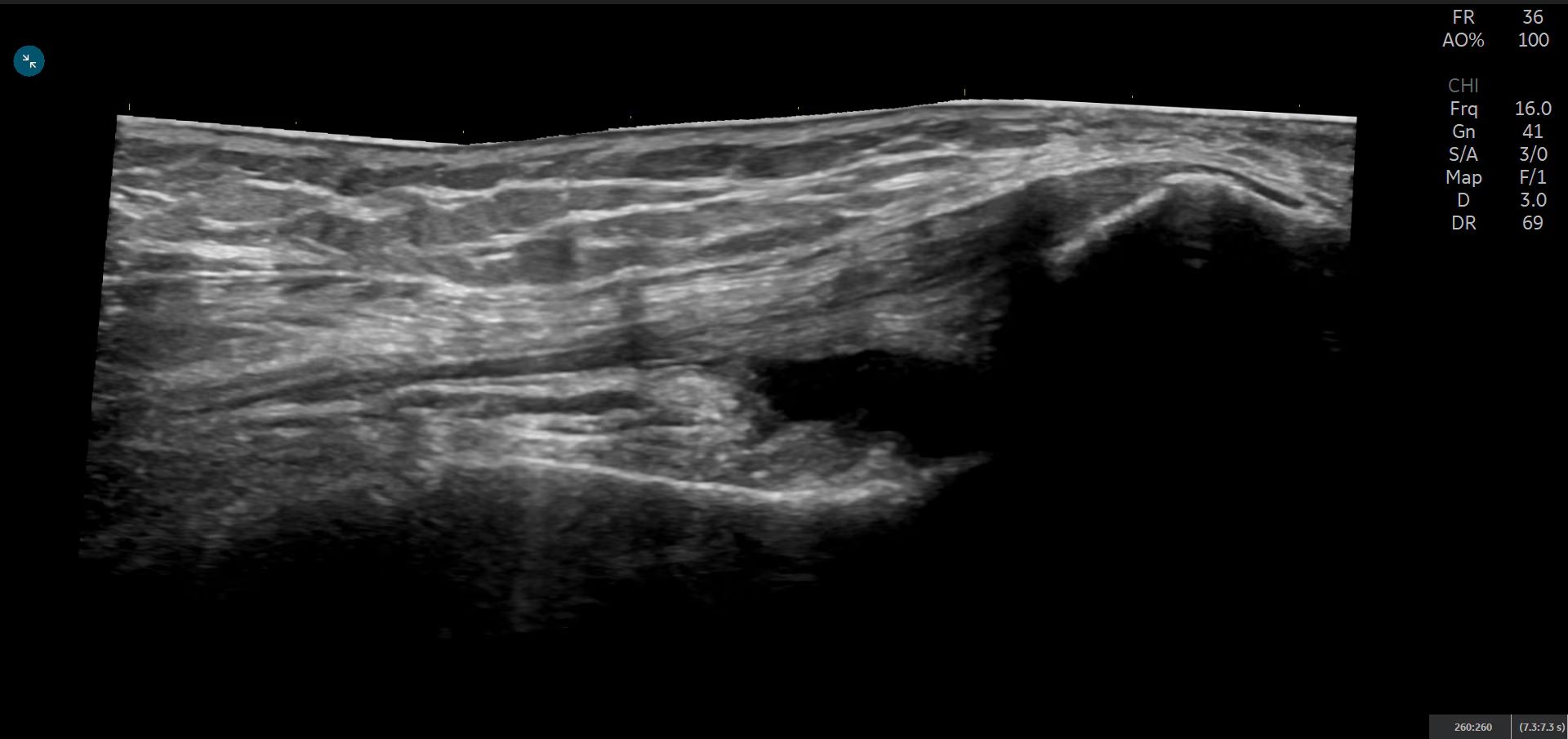 Product Media Carousel Image