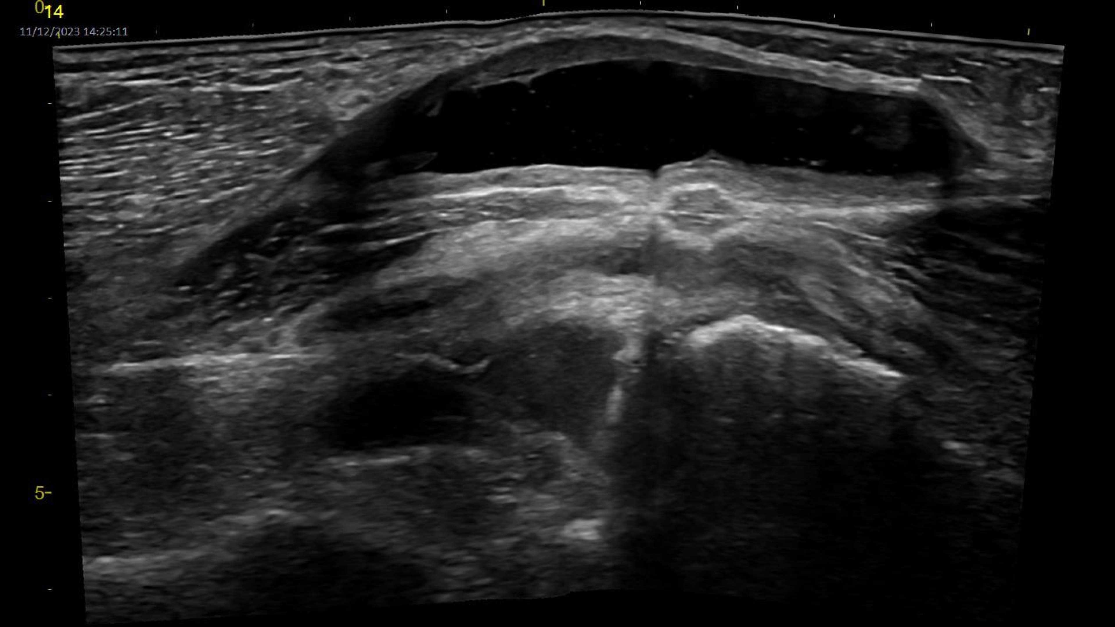 Product Media Carousel Image