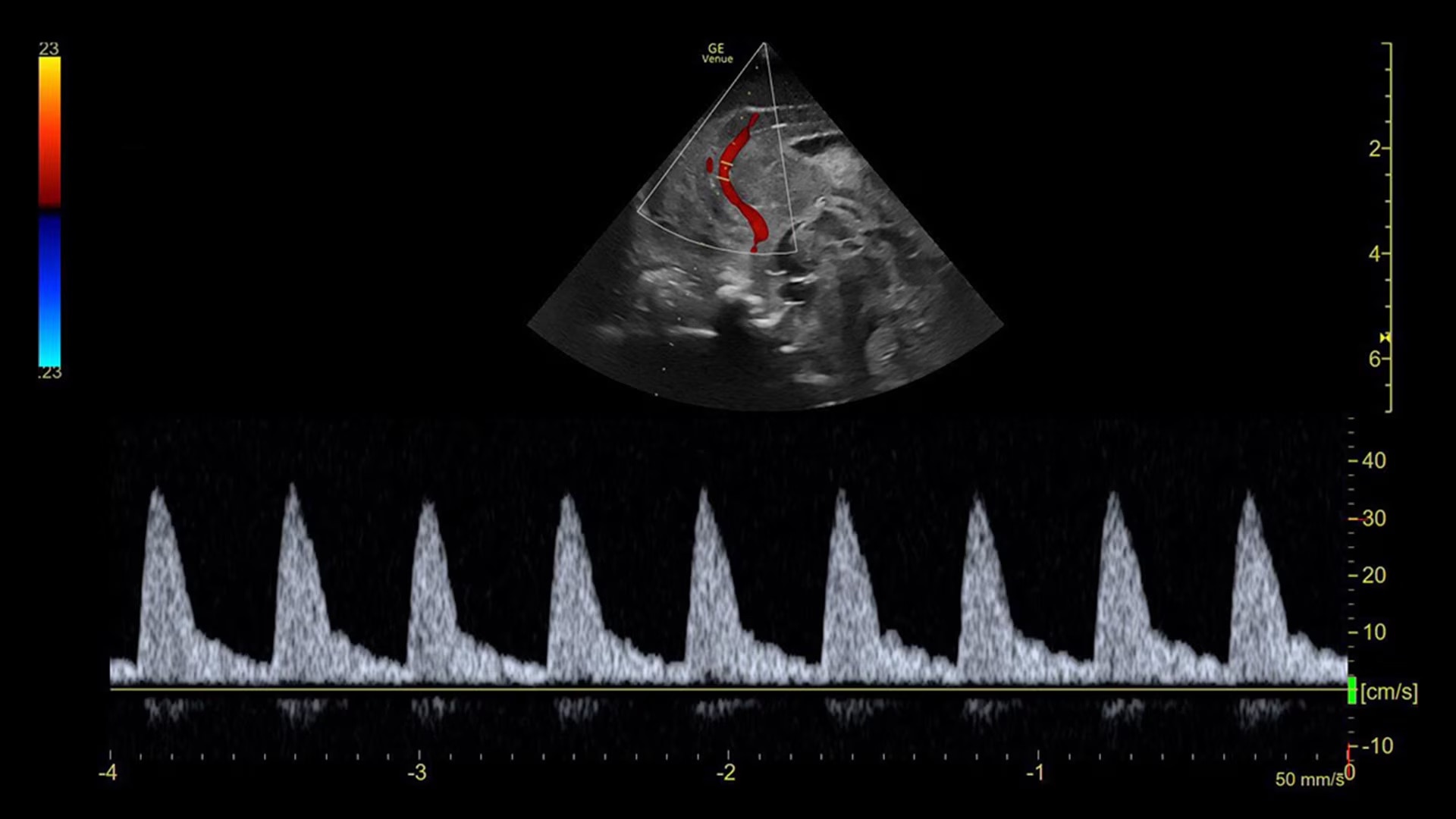 Product Media Carousel Image