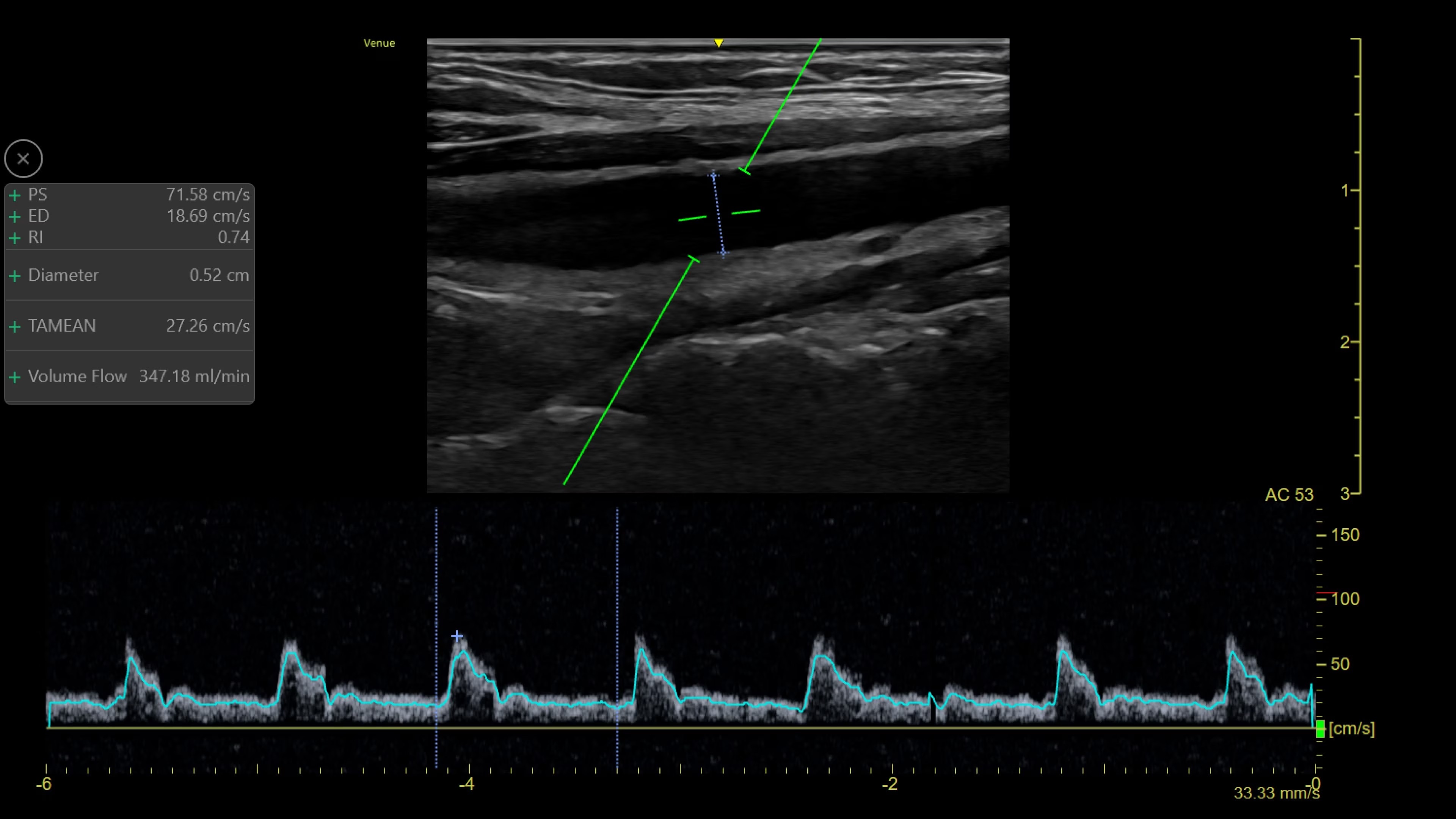 Product Media Carousel Image