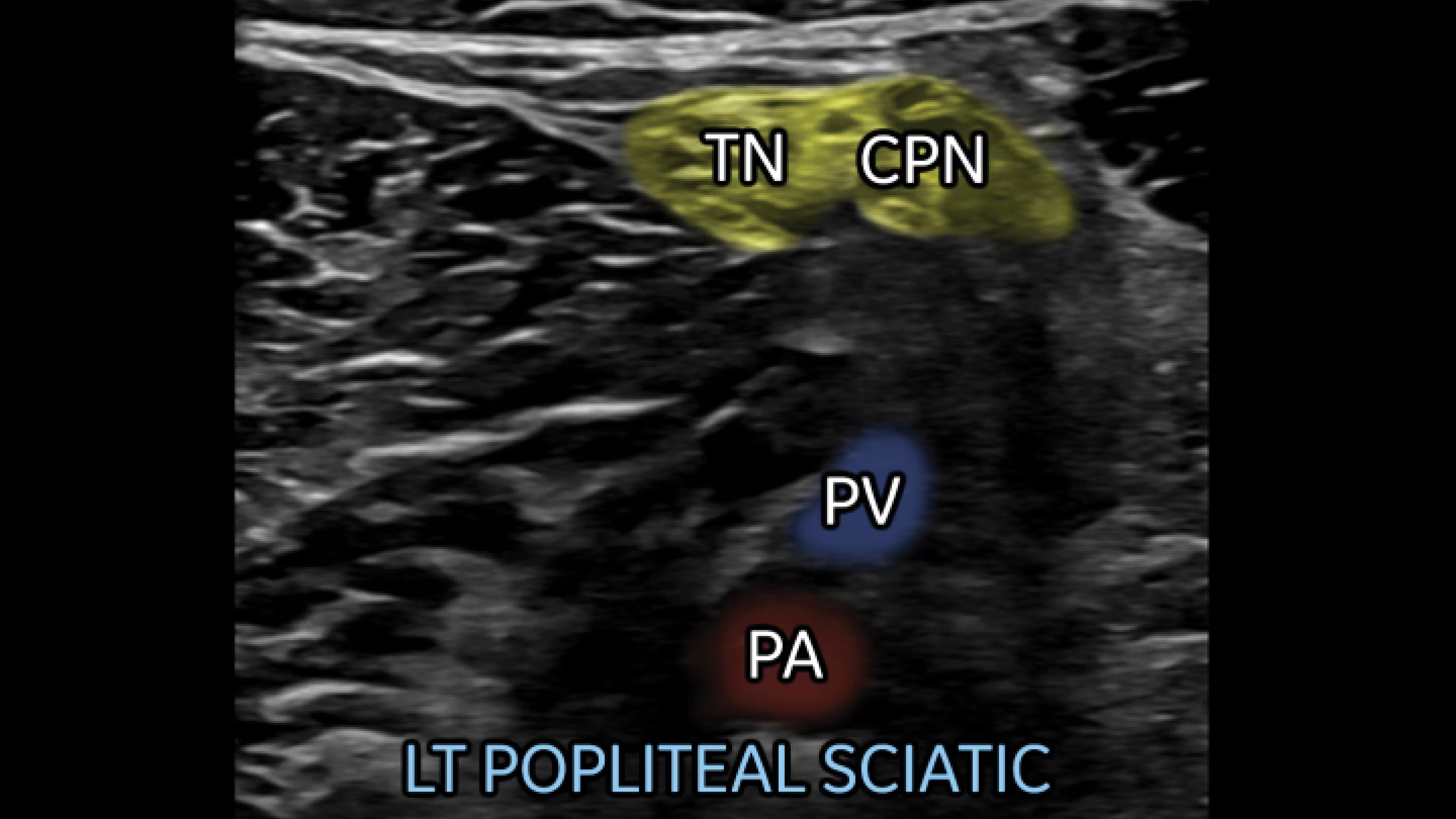 Product Media Carousel Image