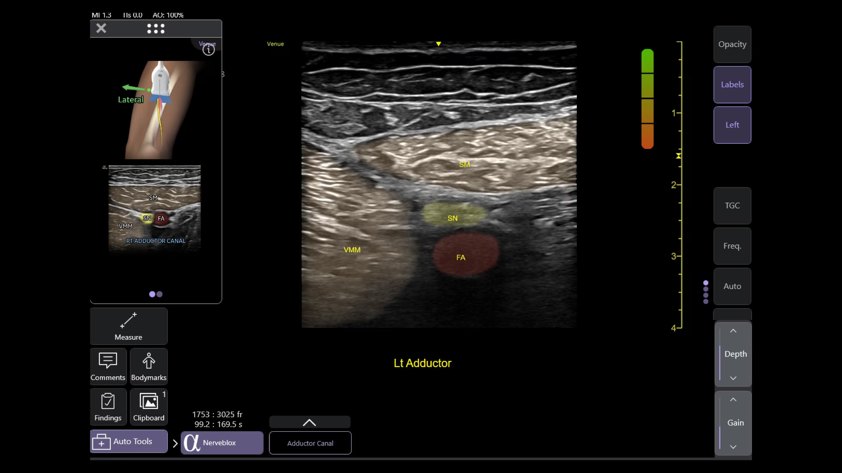 Product Media Carousel Image