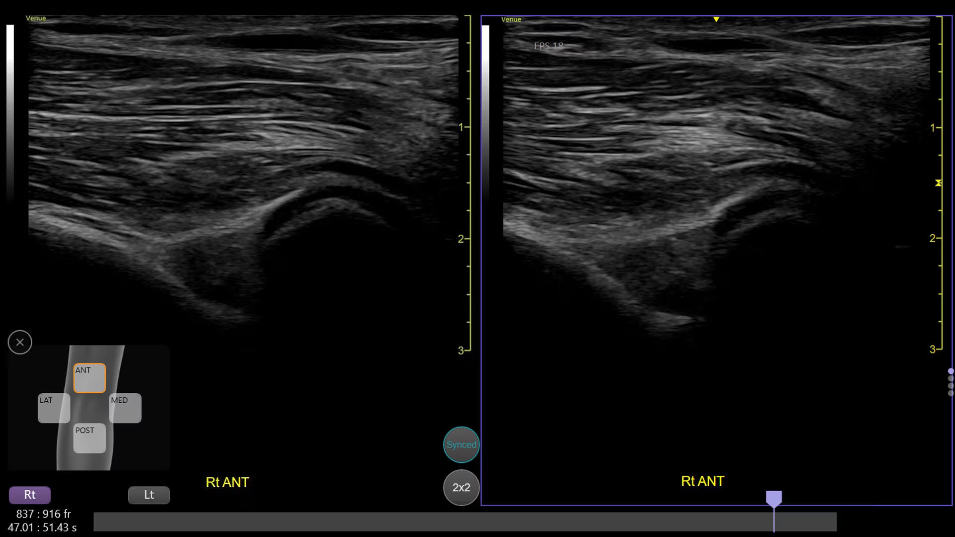 Product Media Carousel Image