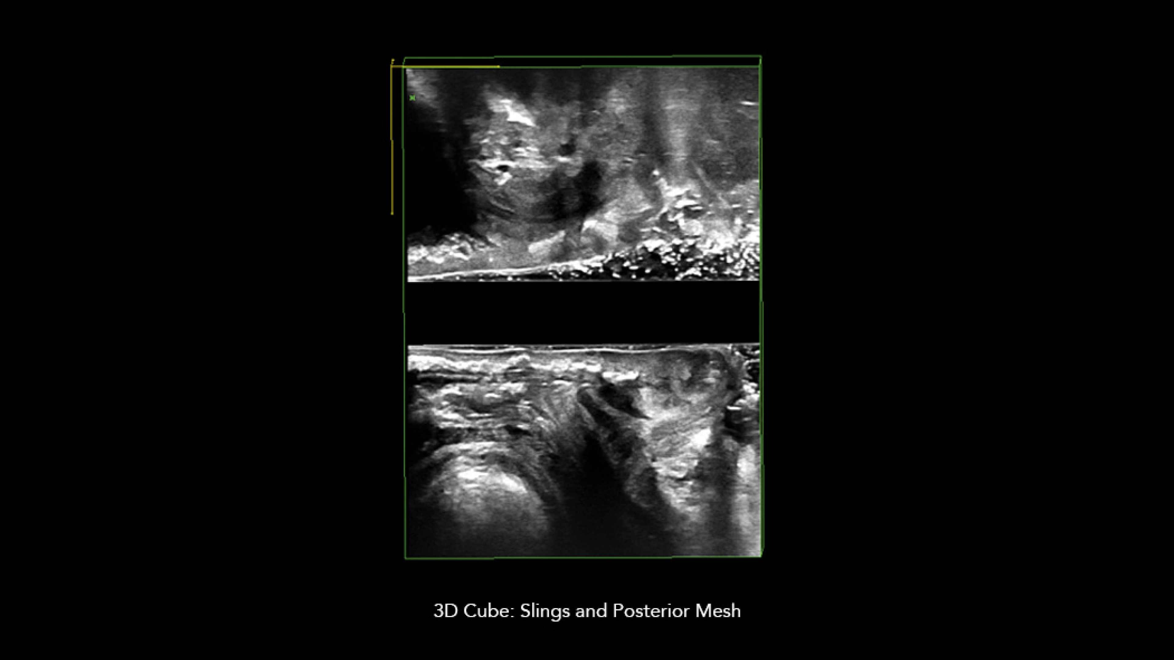 Product Media Carousel Image