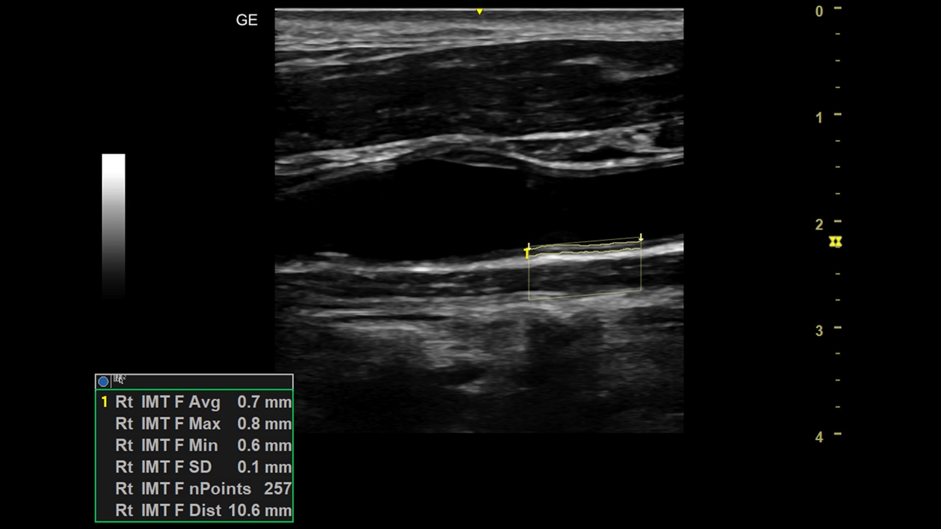 Product Media Carousel Image