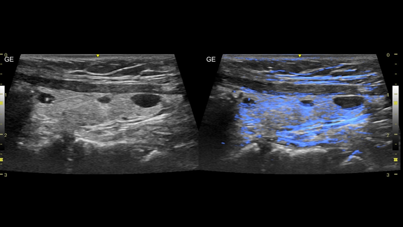 Product Media Carousel Image