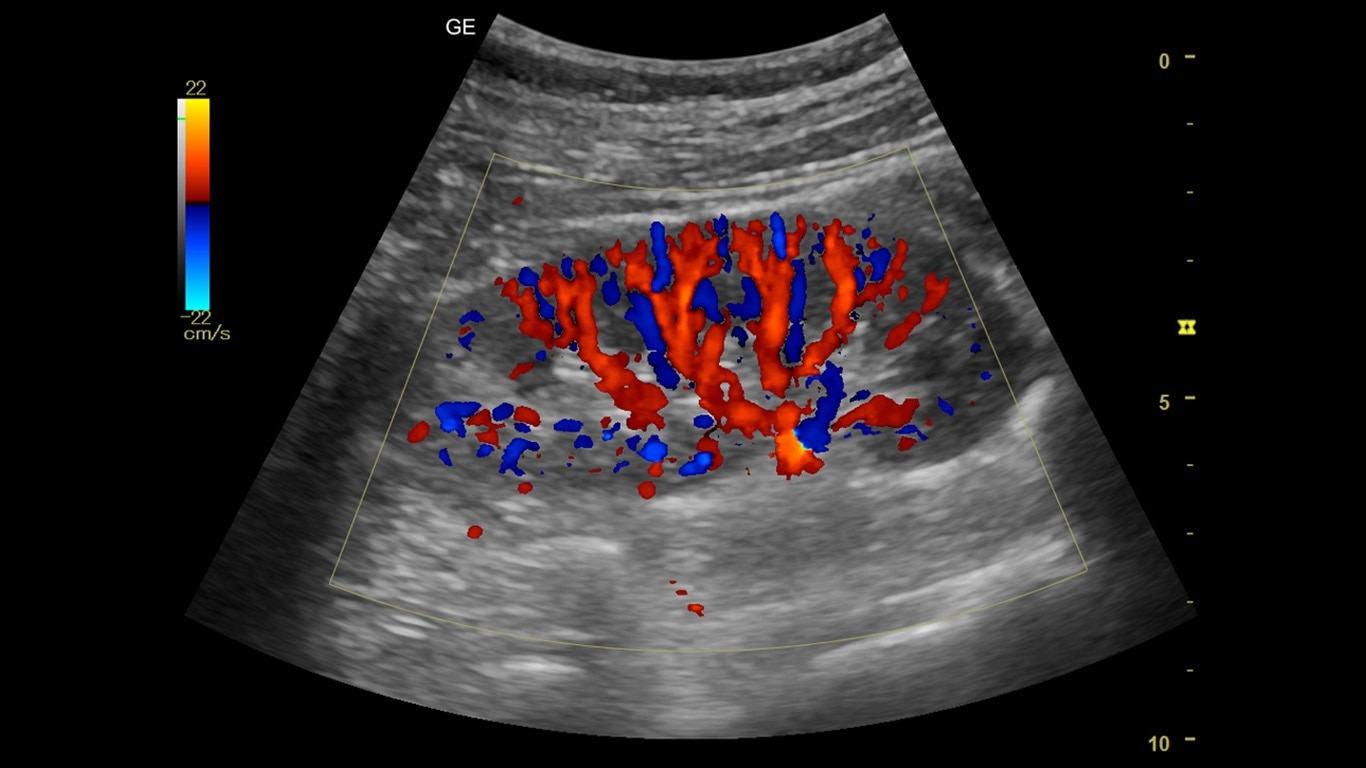 Product Media Carousel Image