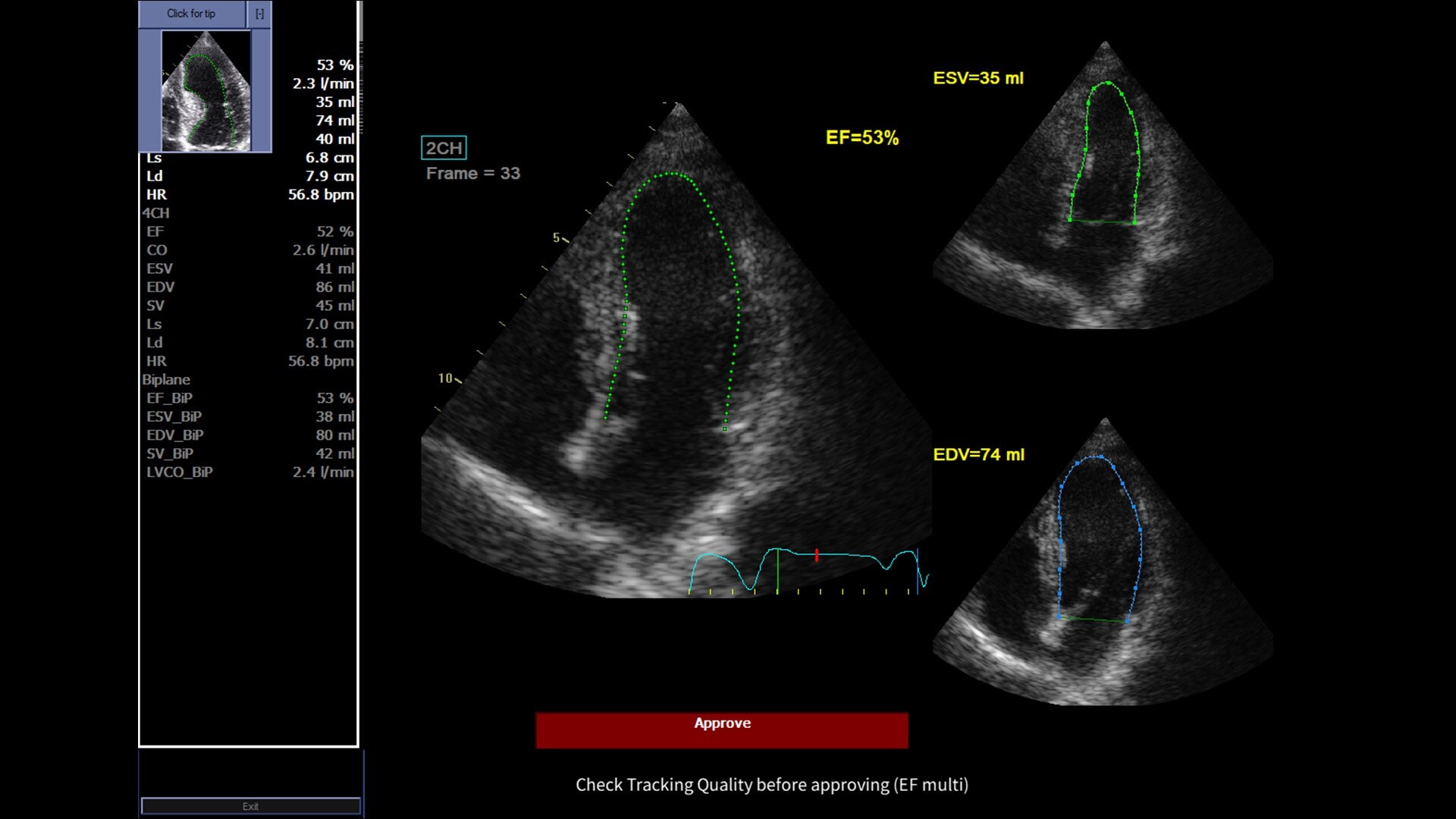 Product Media Carousel Image