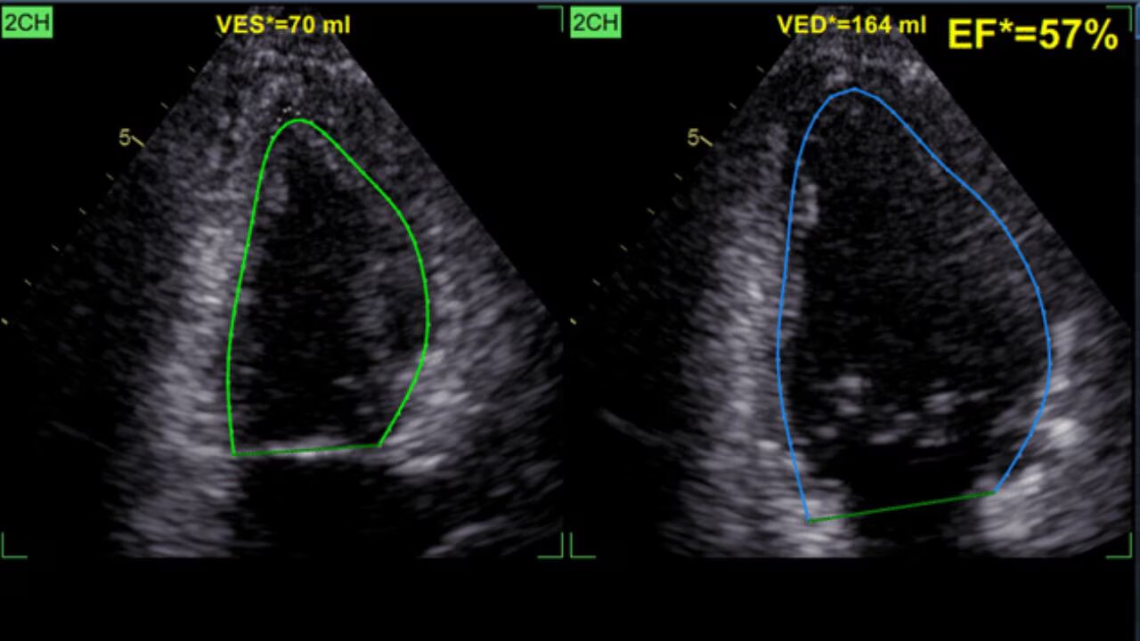 Product Media Carousel Image