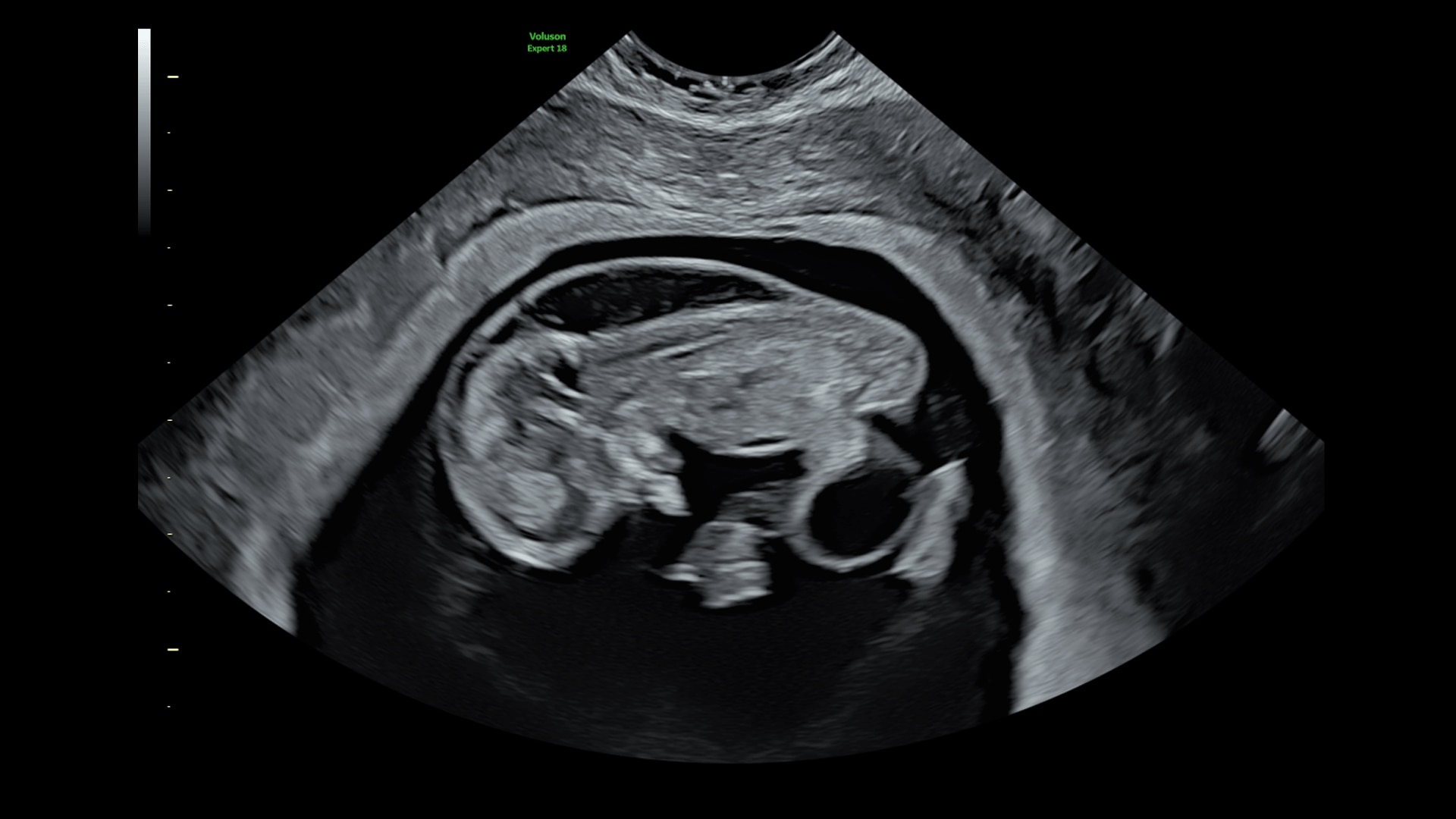 Product Media Carousel Image