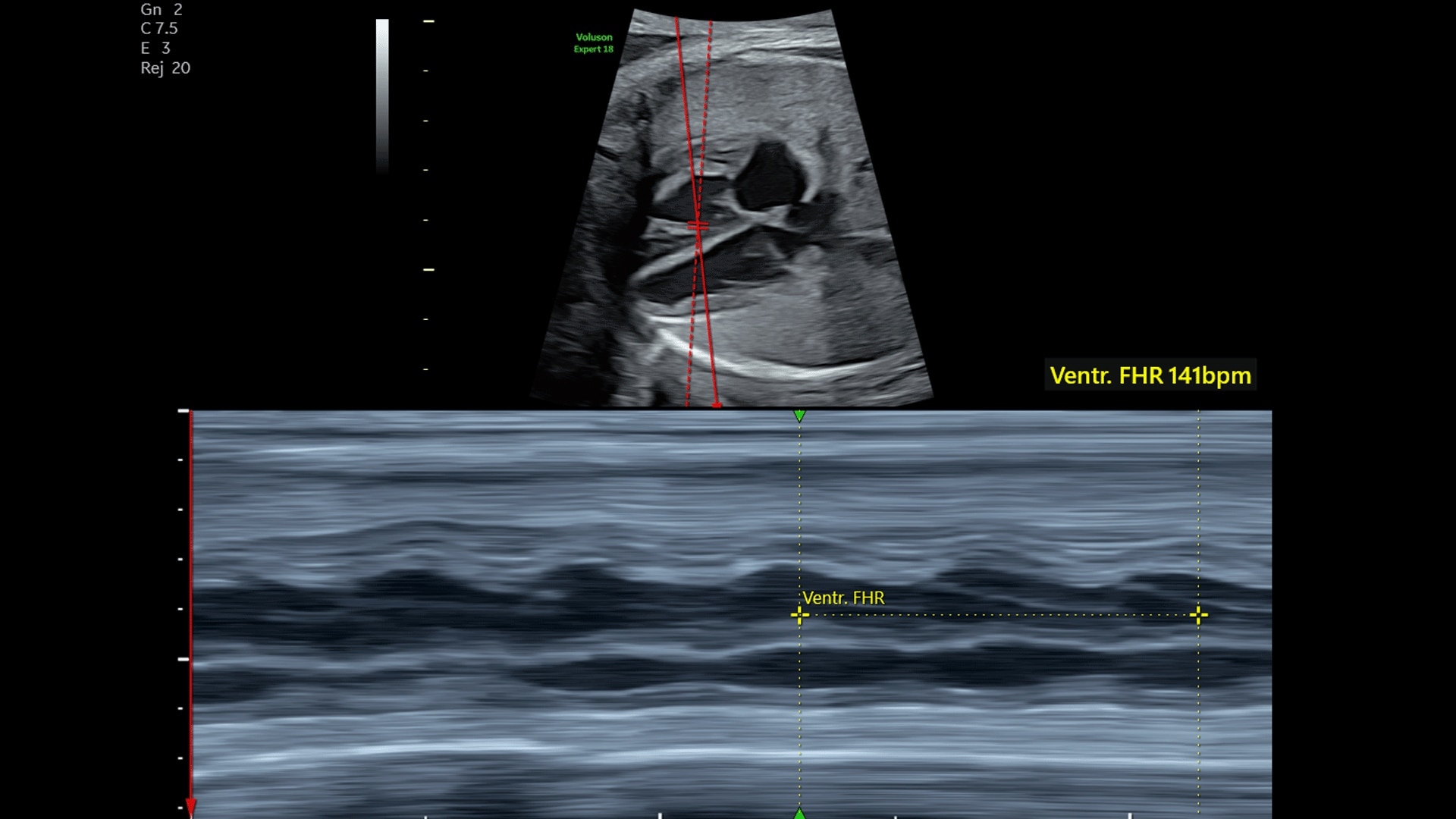 Product Media Carousel Image