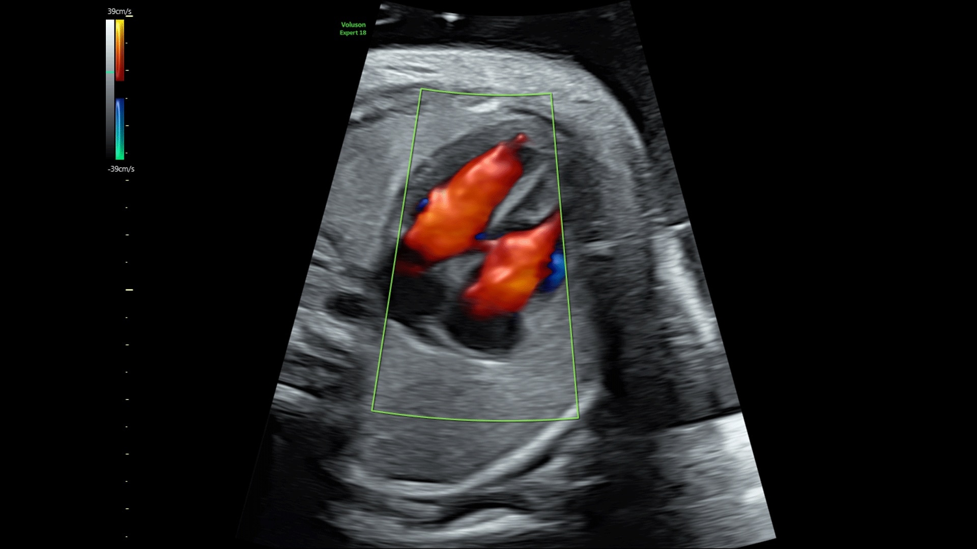 Product Media Carousel Image