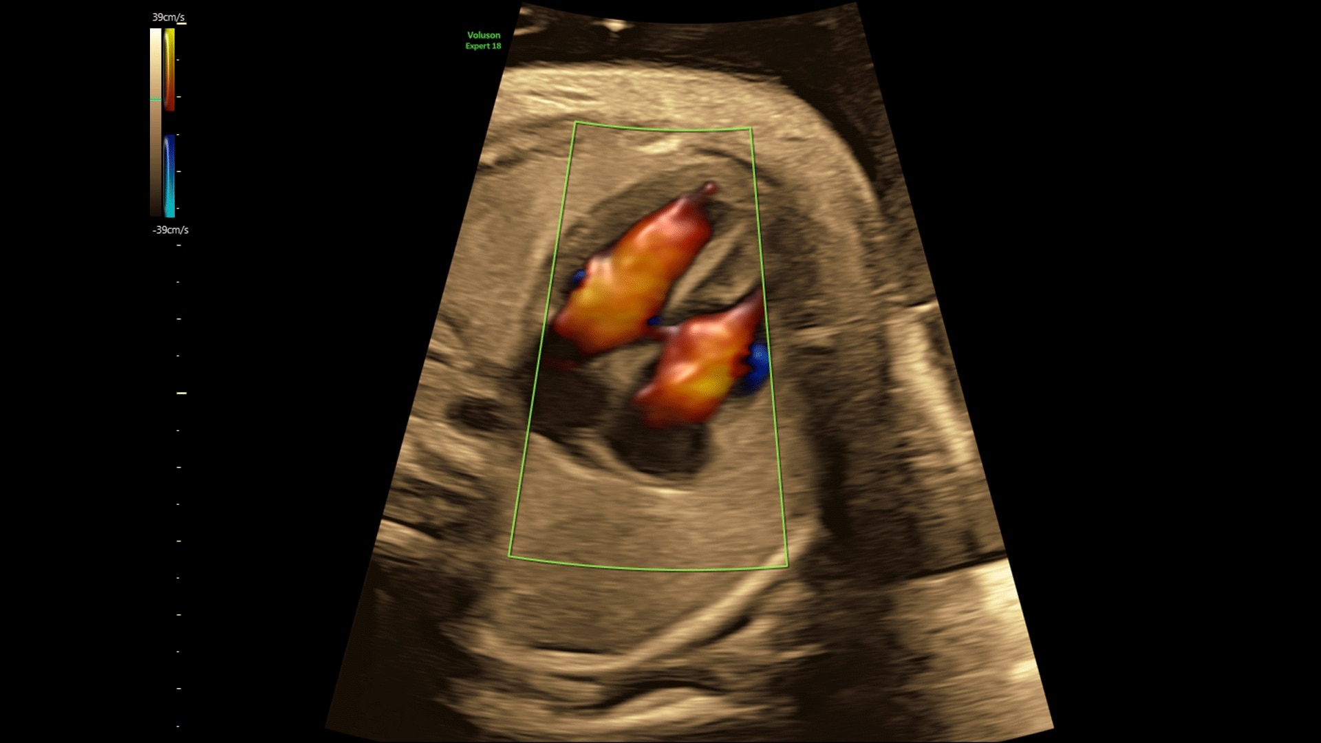 Product Media Carousel Image