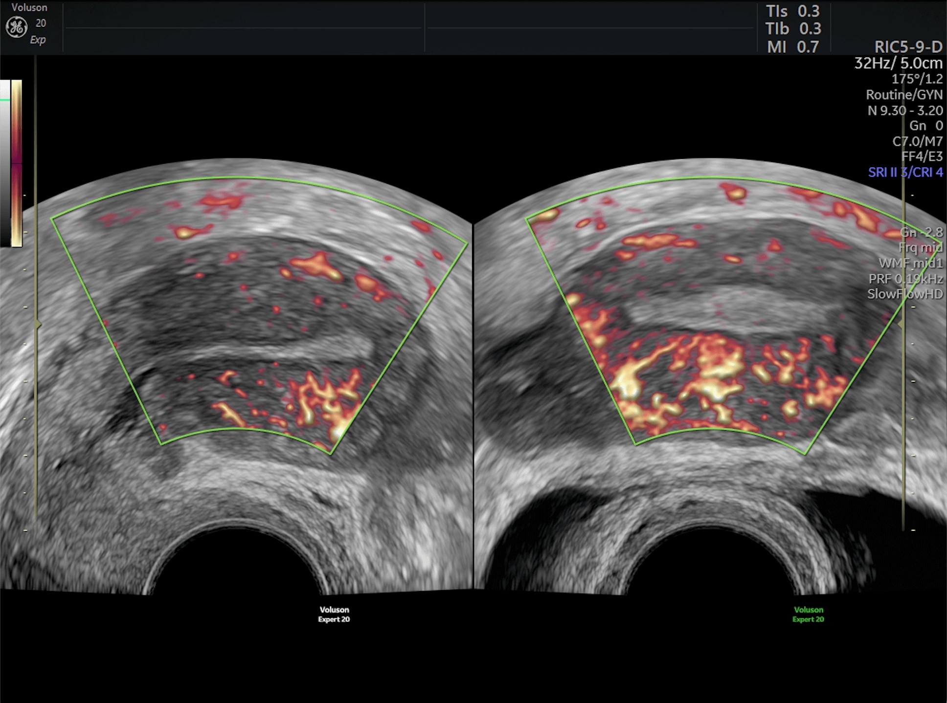 Product Media Carousel Image