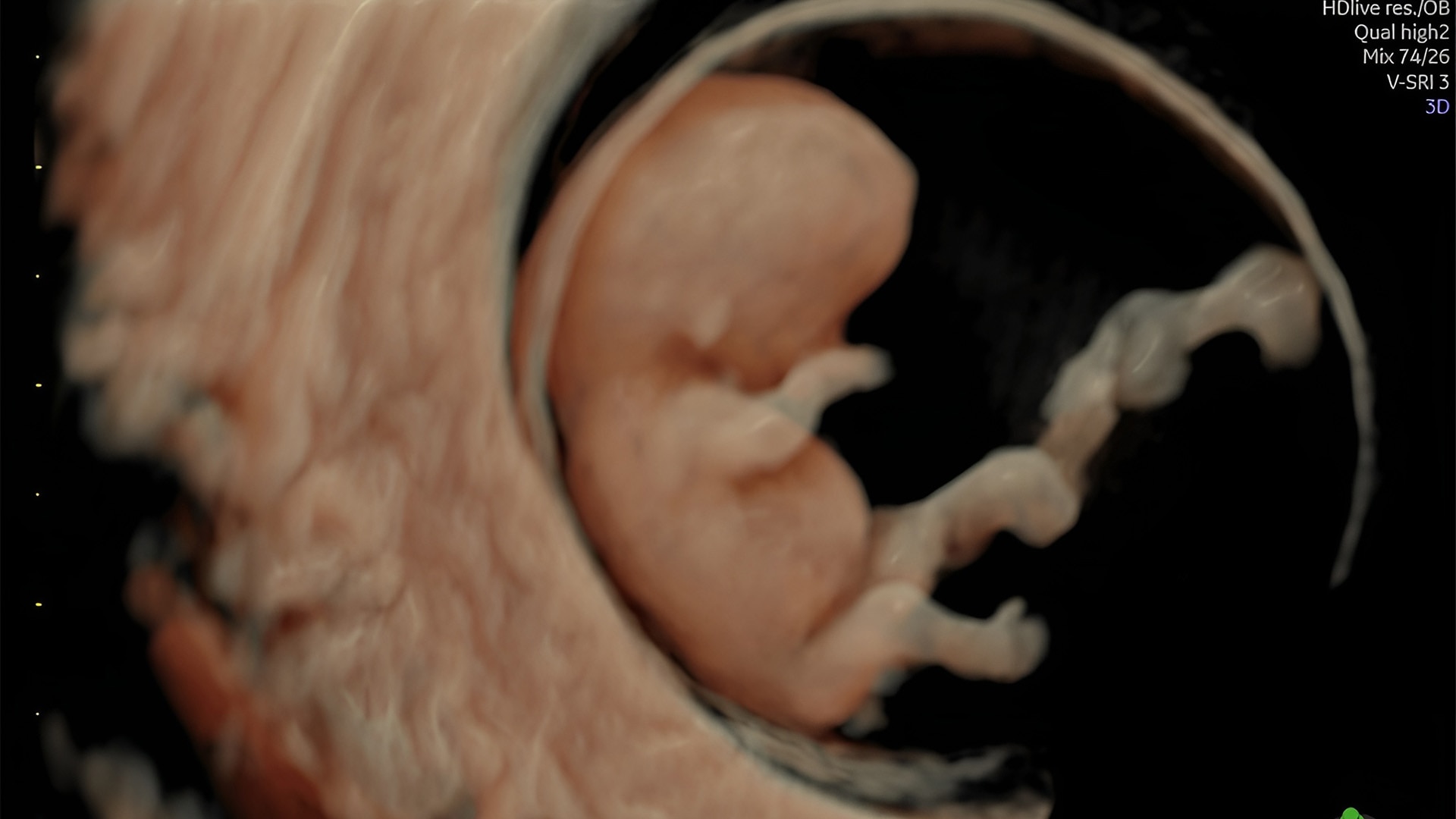 Product Media Carousel Image