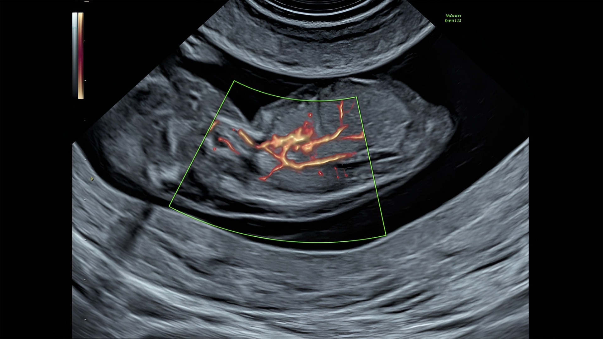 Product Media Carousel Image