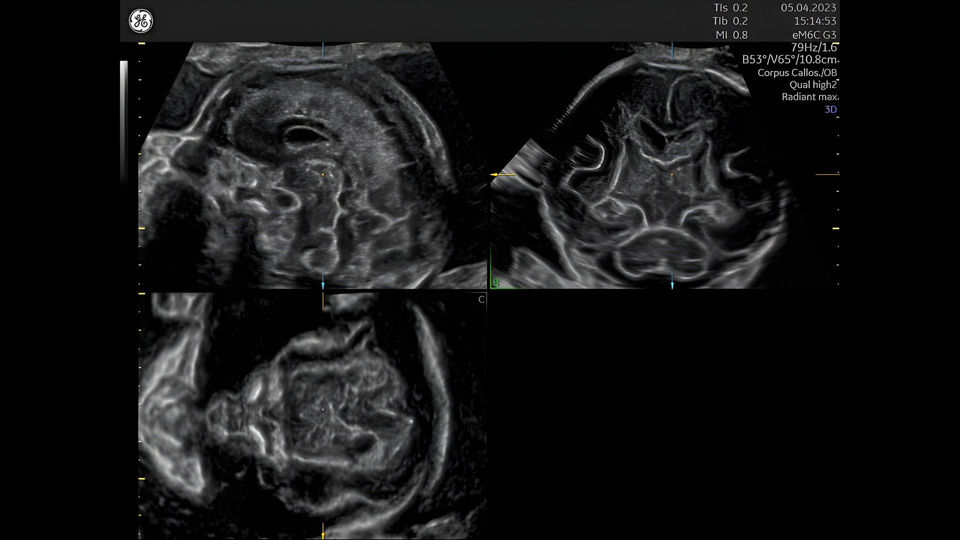 Product Media Carousel Image