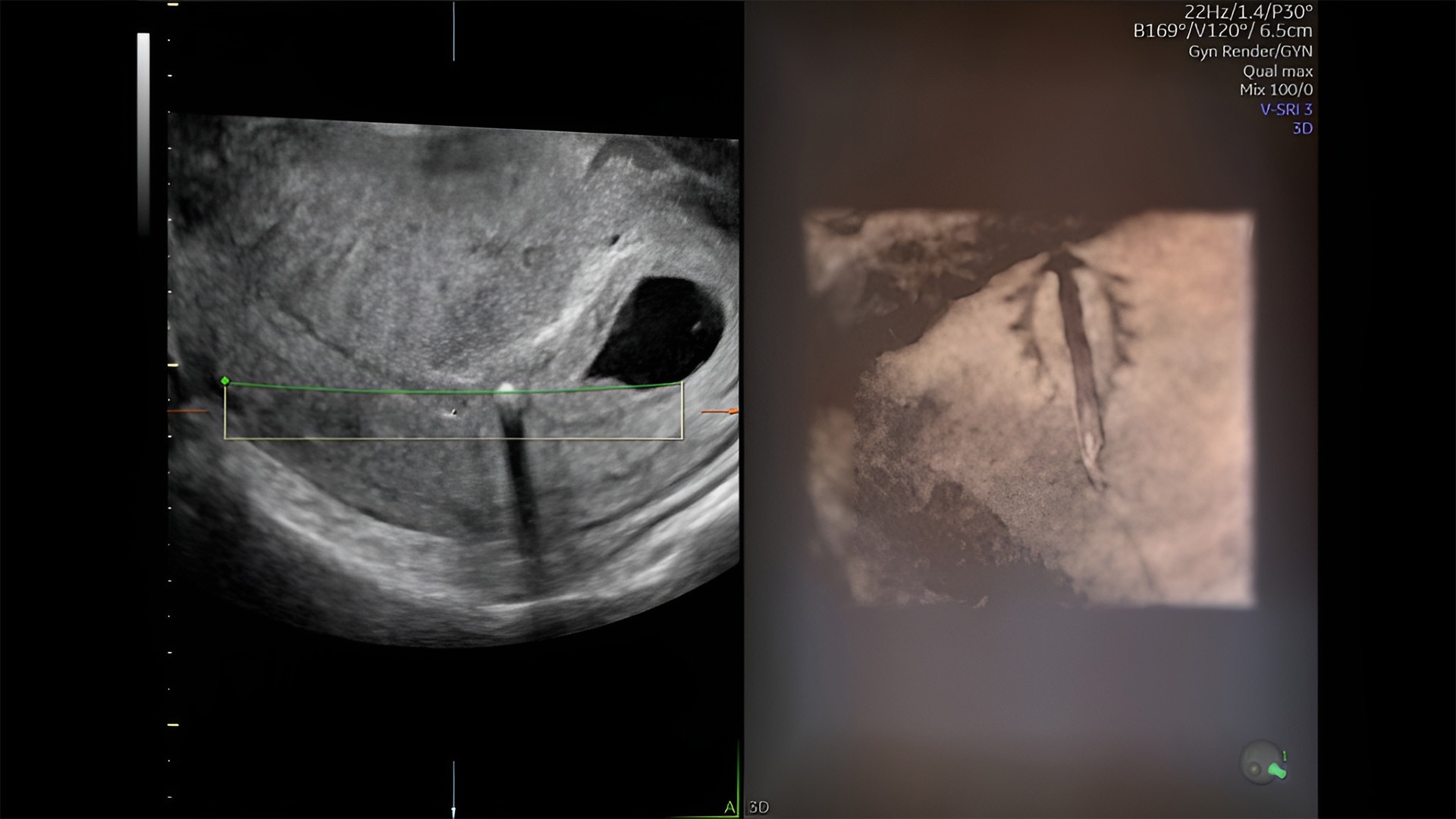 Product Media Carousel Image