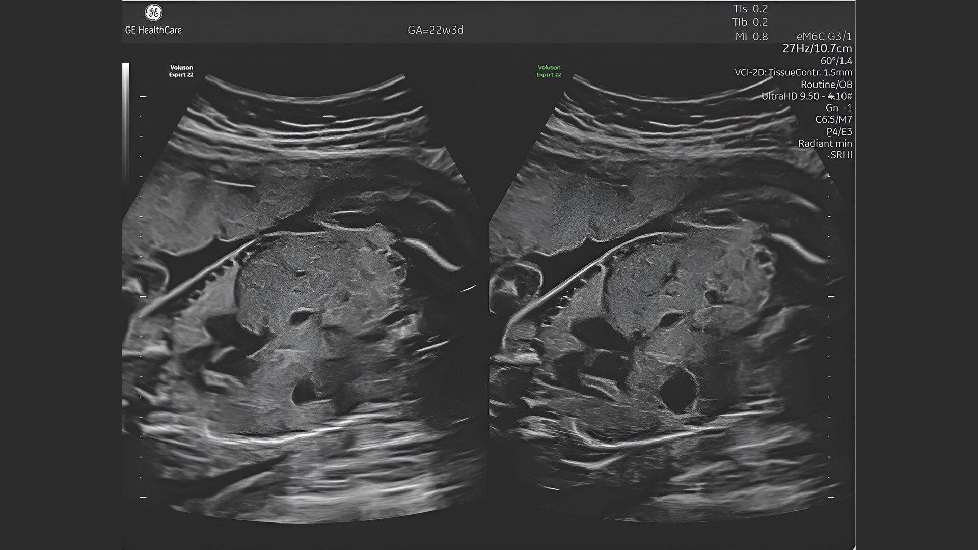 Product Media Carousel Image