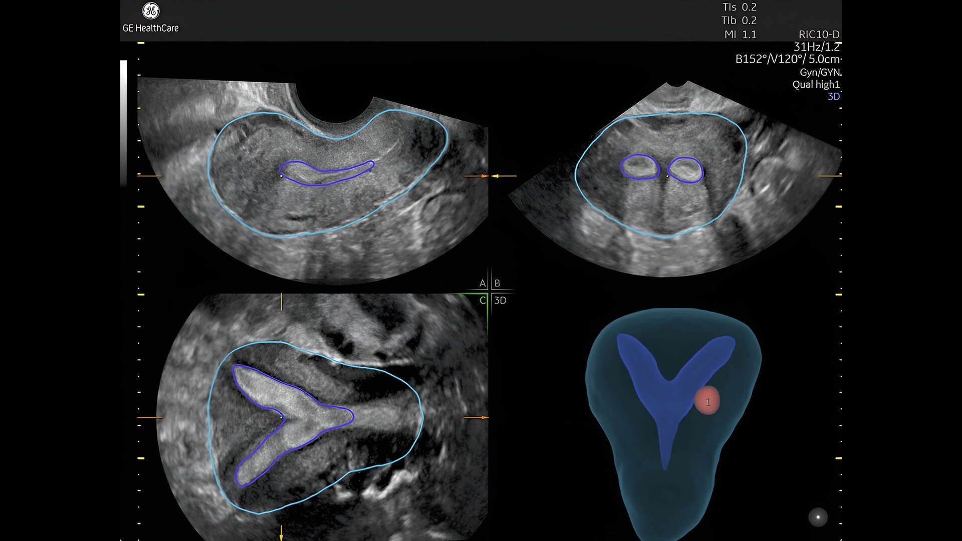 Product Media Carousel Image