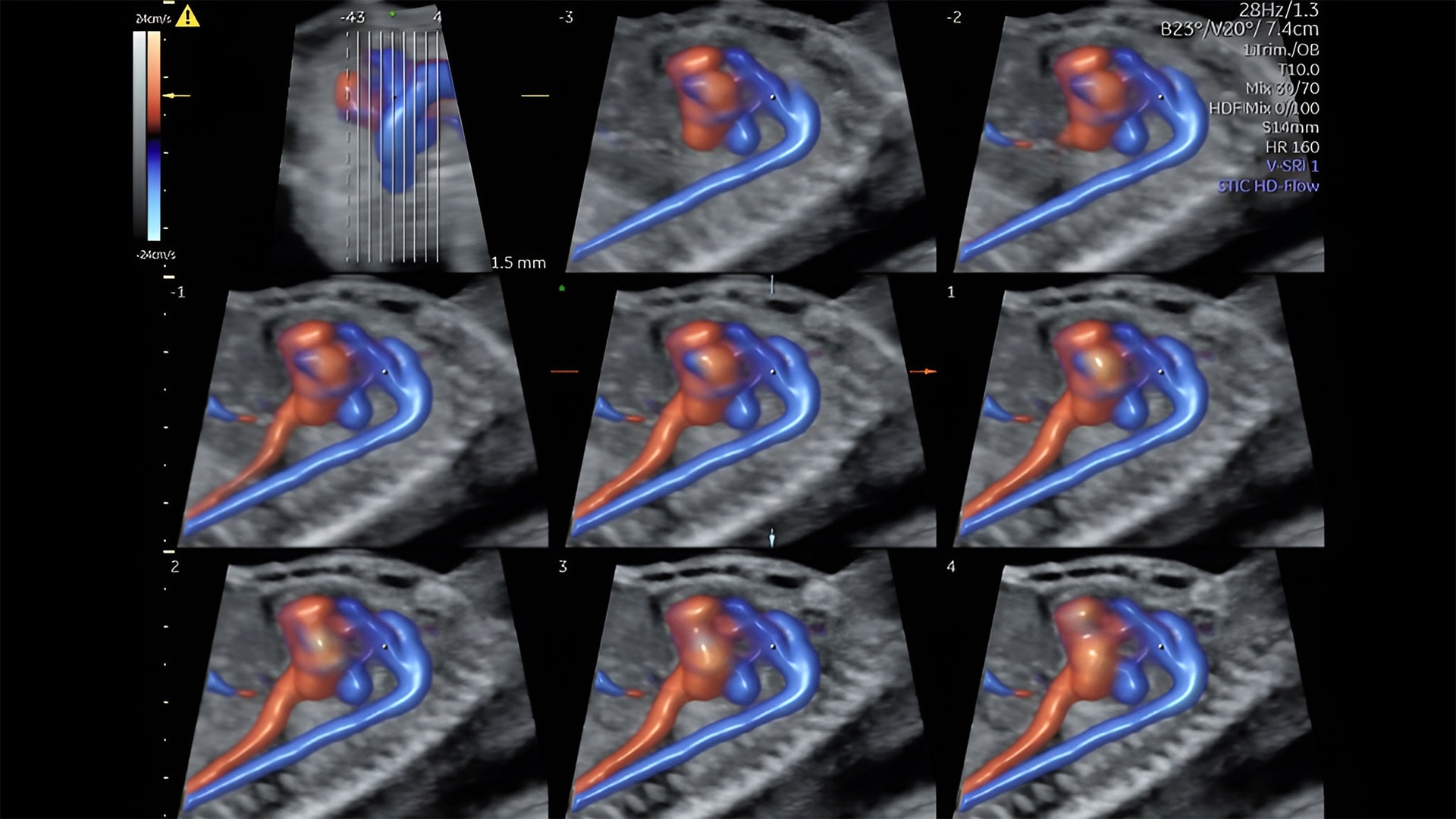 Product Media Carousel Image