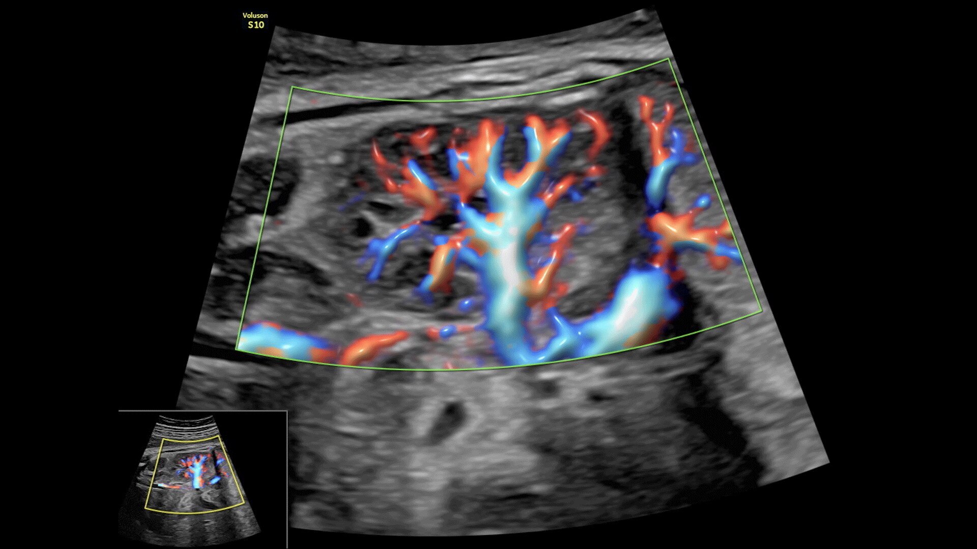 Product Media Carousel Image