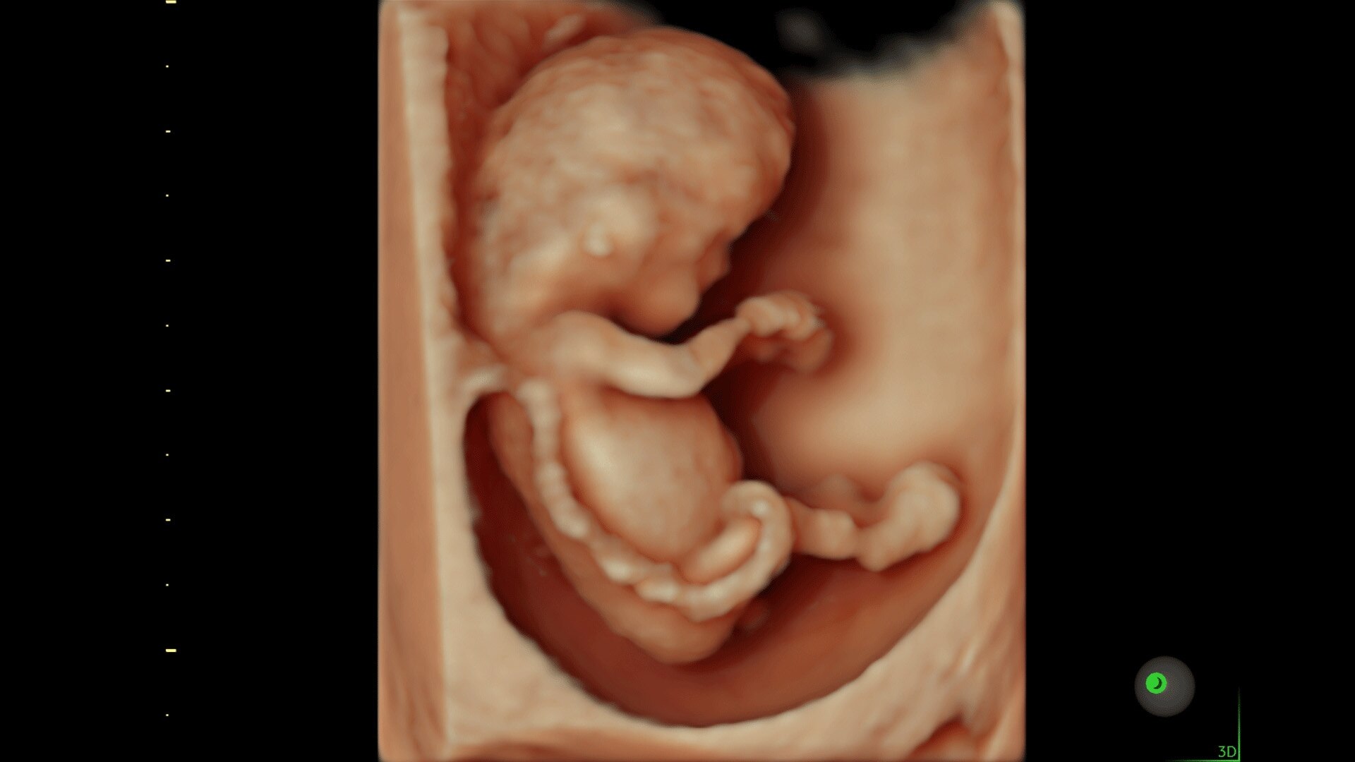 Product Media Carousel Image